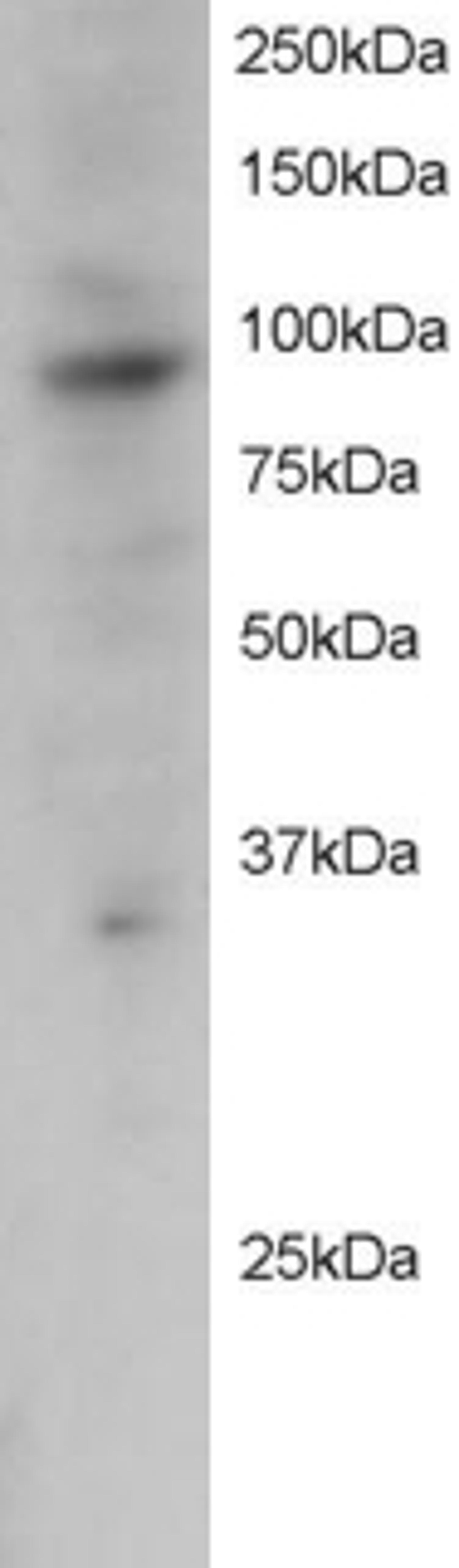 46-214 staining (2ug/ml) of Jurkat lysate (RIPA buffer, 30ug total protein per lane). Primary incubated for 12 hour. Detected by western blot using chemiluminescence.