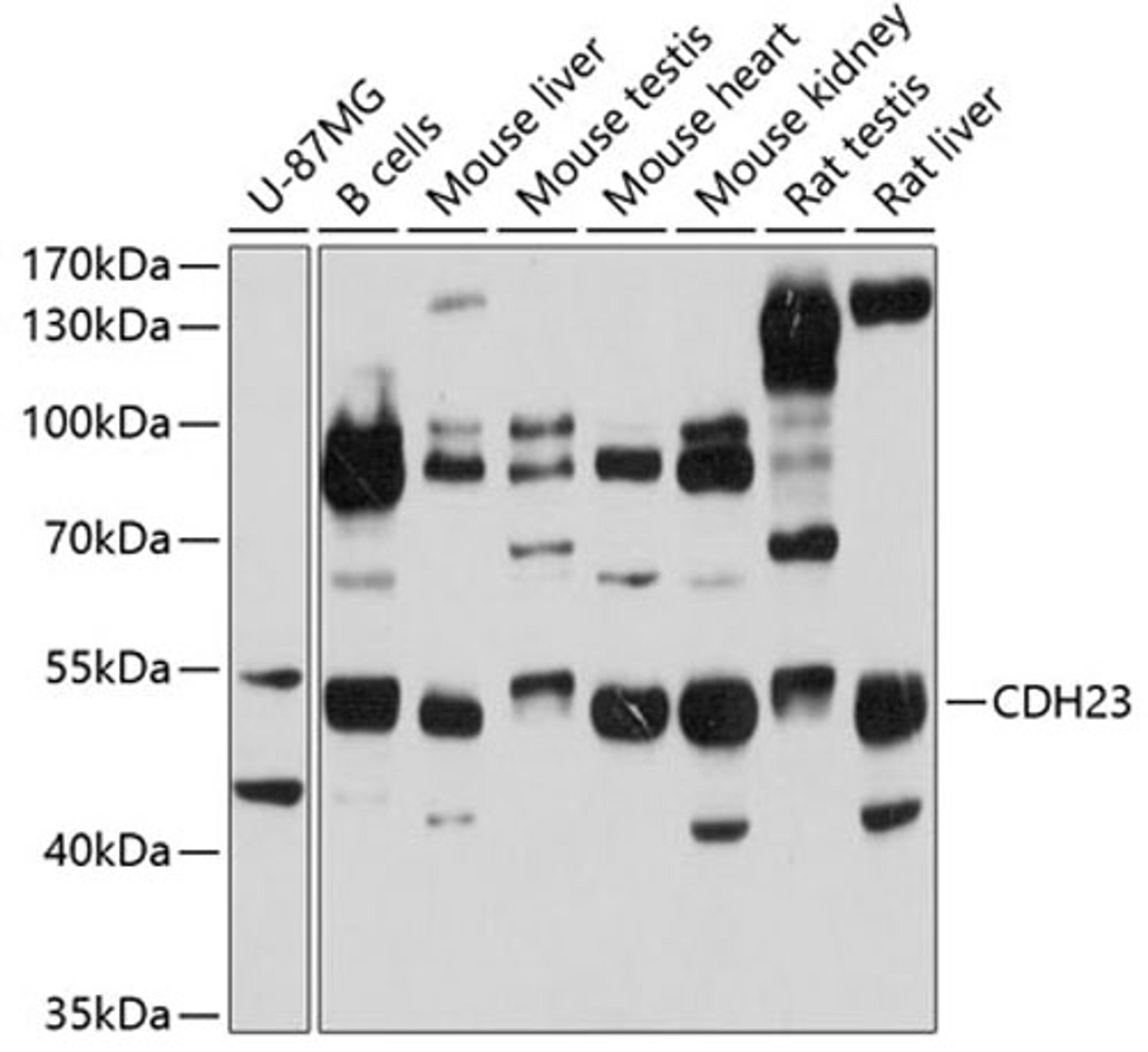 Western blot - CDH23 antibody (A4918)