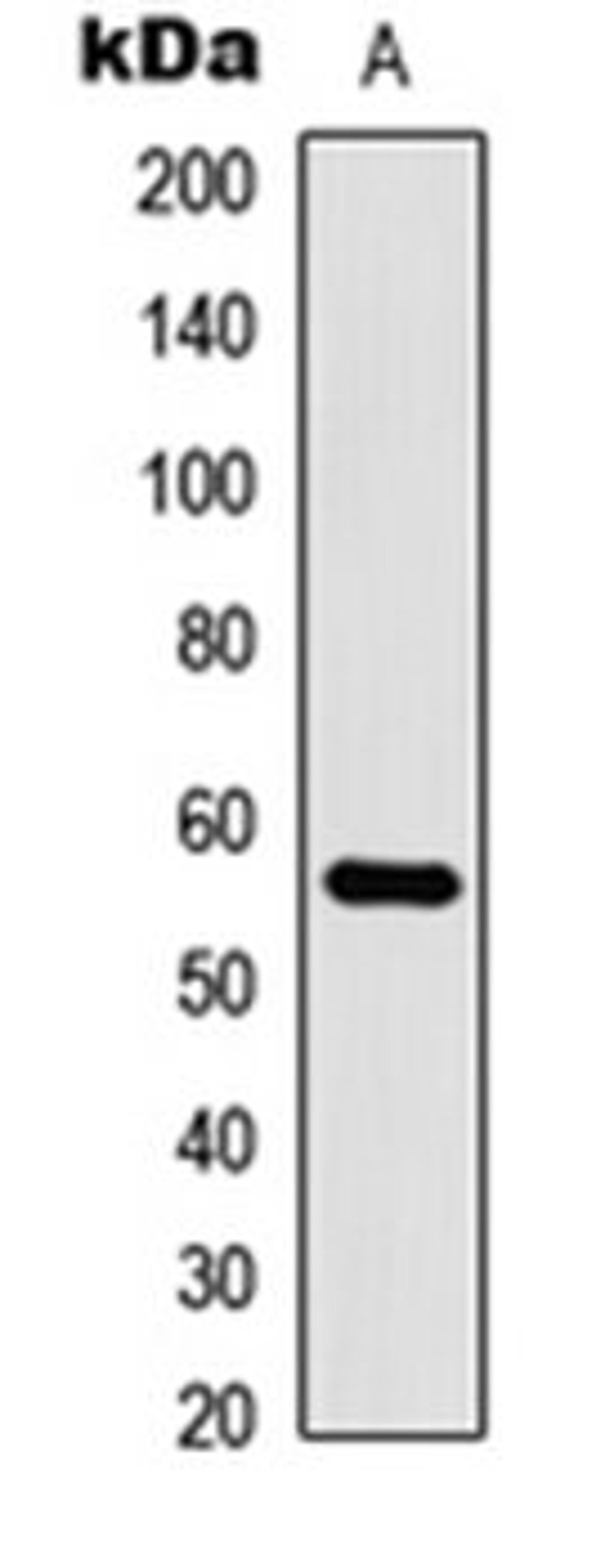 Western blot analysis of HL60 (Lane 1) whole cell lysates using CLK1 antibody