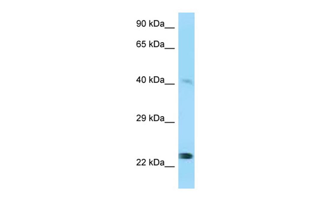 Antibody used in WB on Human HepG2 at 0.2-1 ug/ml.