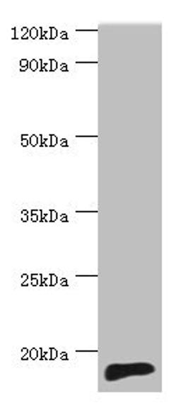 Western blot. All lanes: TNNC2 antibody at 10ug/ml + Mouse skeletal muscle tissue. Secondary. Goat polyclonal to rabbit IgG at 1/10000 dilution. Predicted band size: 18 kDa. Observed band size: 18 kDa.