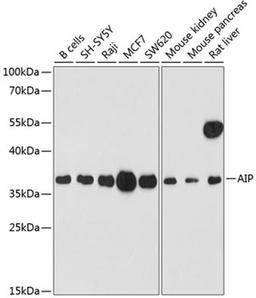 Western blot - AIP antibody (A12546)