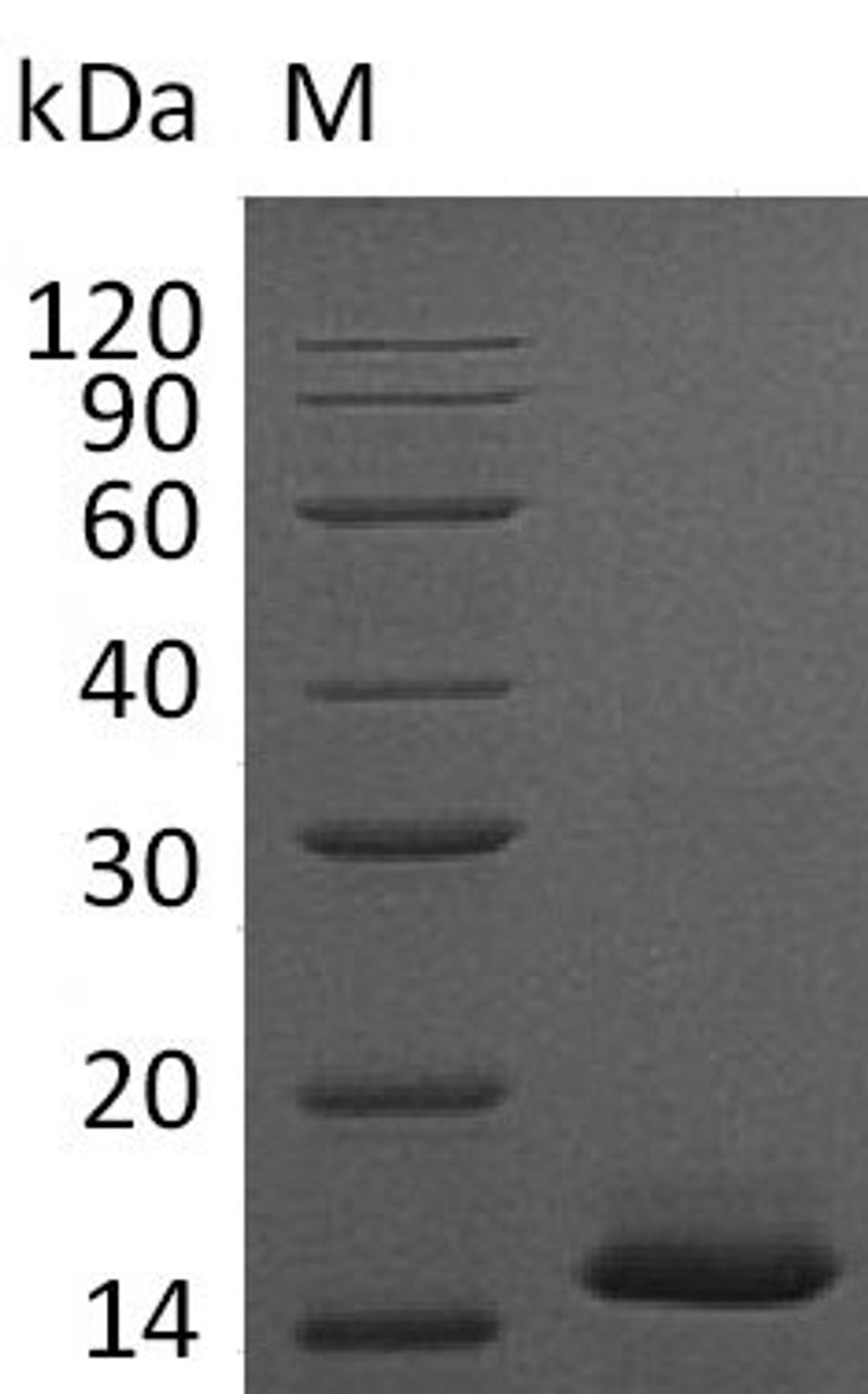 (Tris-Glycine gel) Discontinuous SDS-PAGE (reduced) with 5% enrichment gel and 15% separation gel.