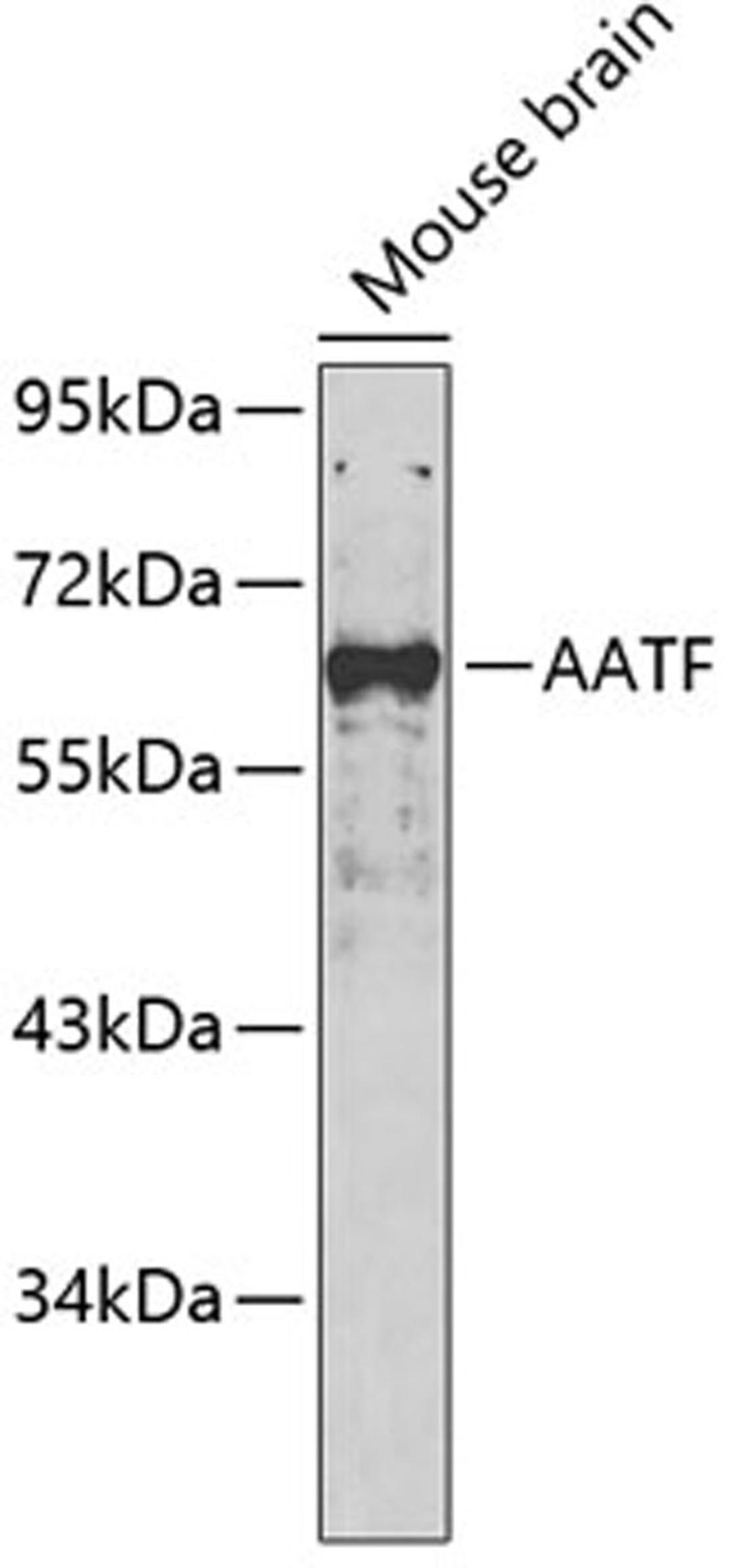 Western blot - AATF antibody (A5896)