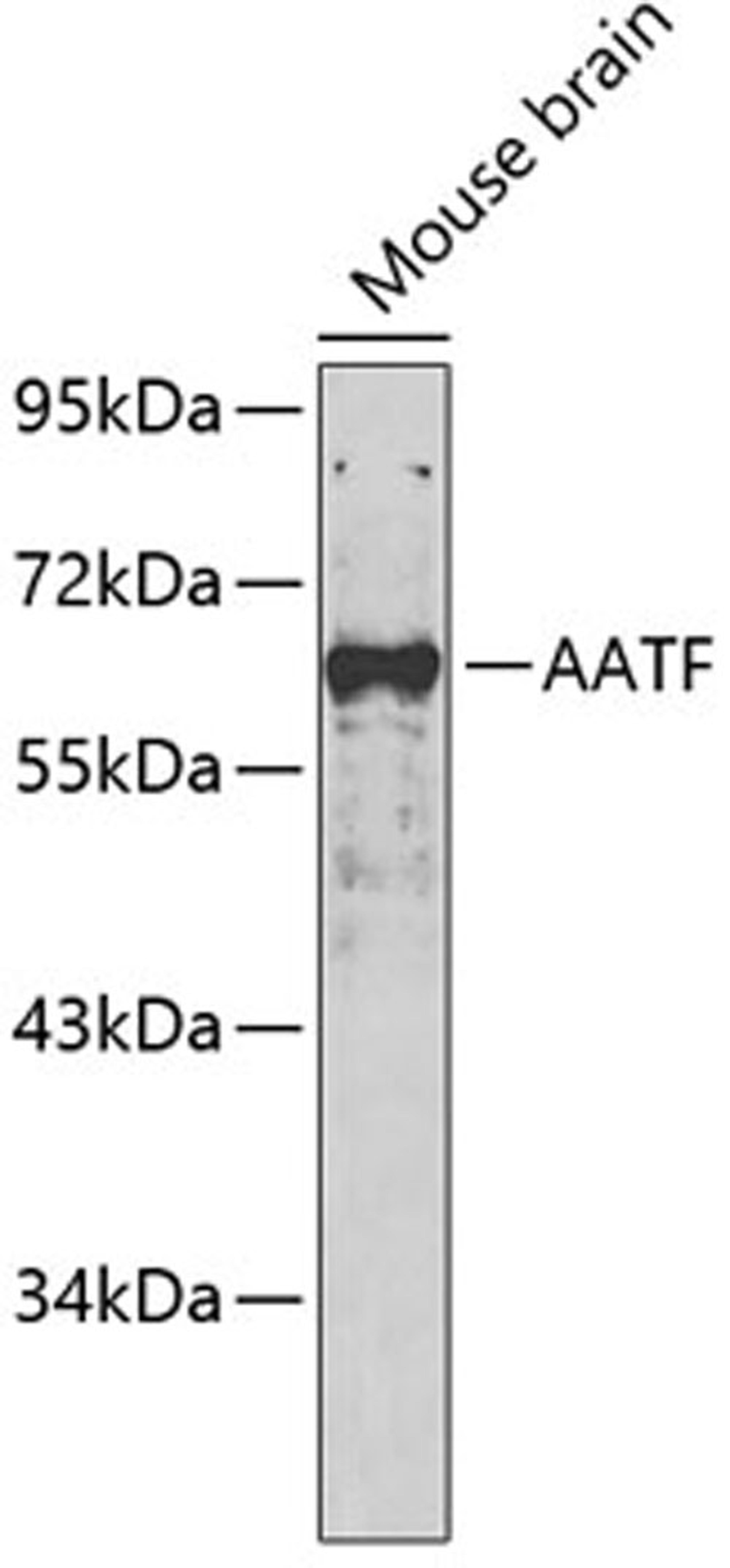 Western blot - AATF antibody (A5896)