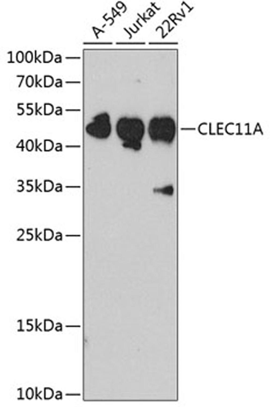 Western blot - CLEC11A antibody (A3634)