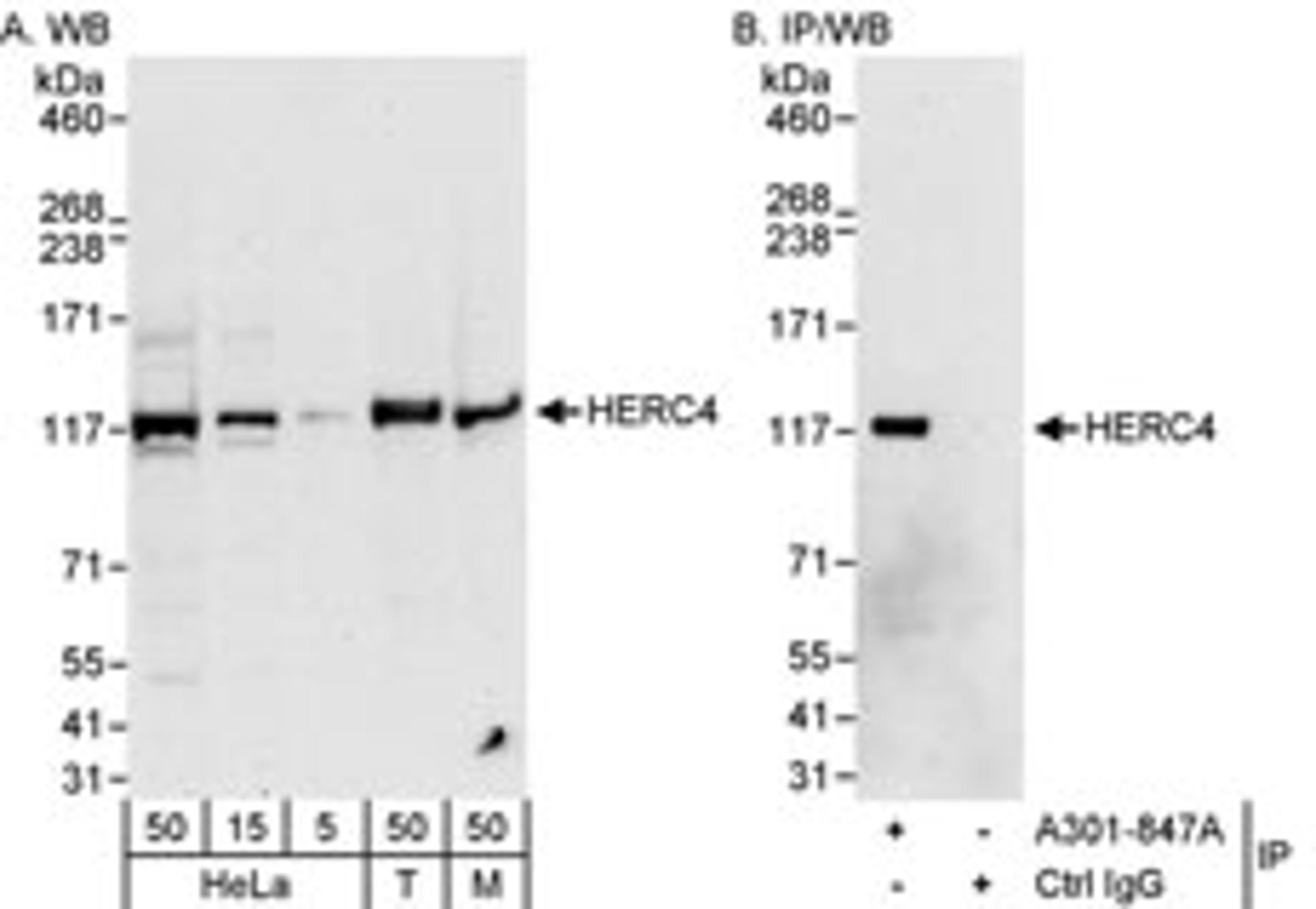 Detection of human and mouse HERC4 by western blot (h&m) and immunoprecipitation (h).