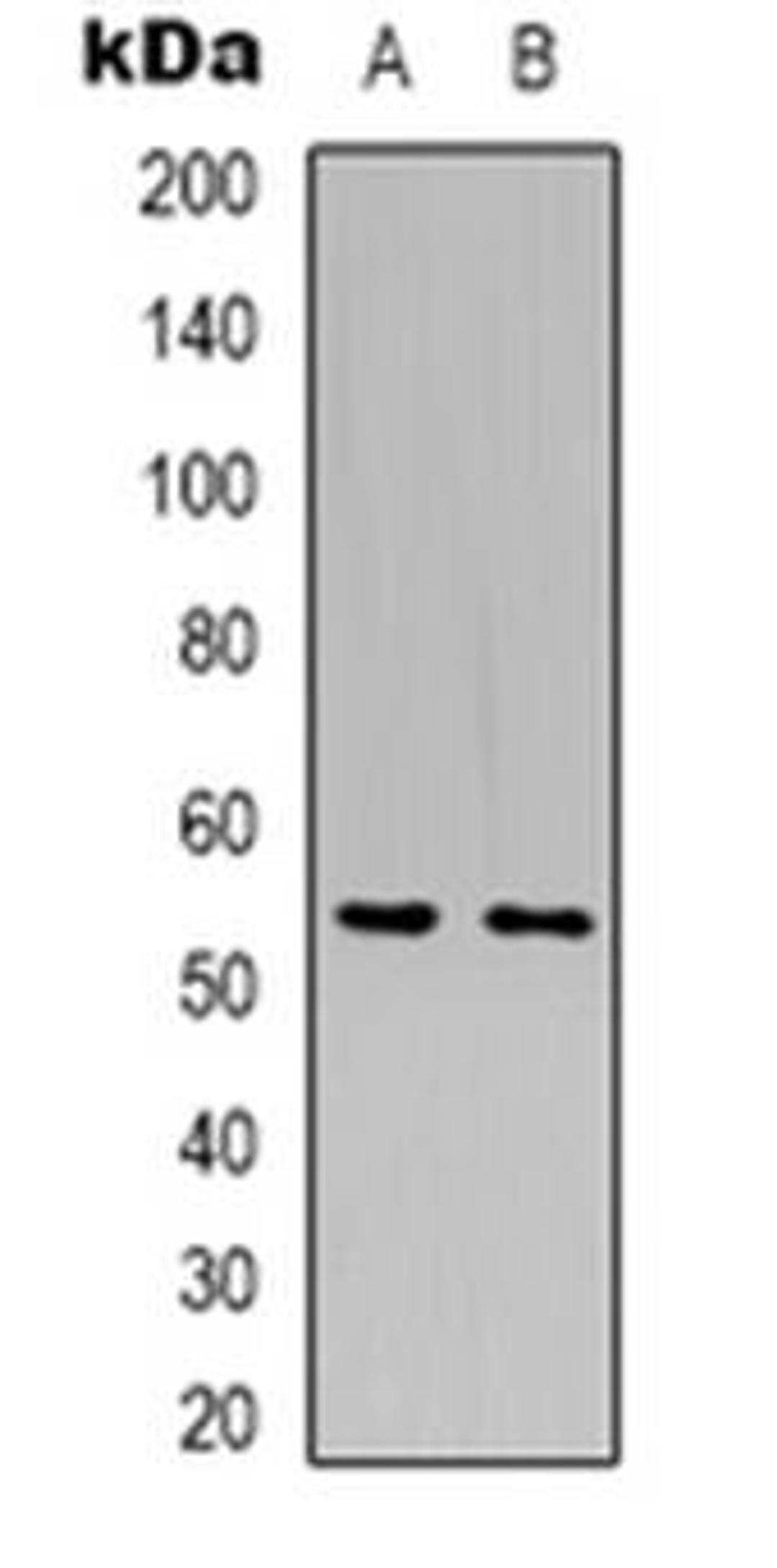 Western blot analysis of GLUT5 expression in Hela (Lane 1), HepG2 (Lane 2) whole cell lysates using SLC2A5 antibody