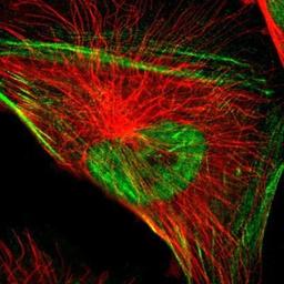 Immunocytochemistry/Immunofluorescence: Nuclear Factor Erythroid Derived 2 Antibody [NBP1-82580] - Staining of human cell line U-251MG shows positivity in nucleus but not nucleoli & cytoskeleton (actin filaments).