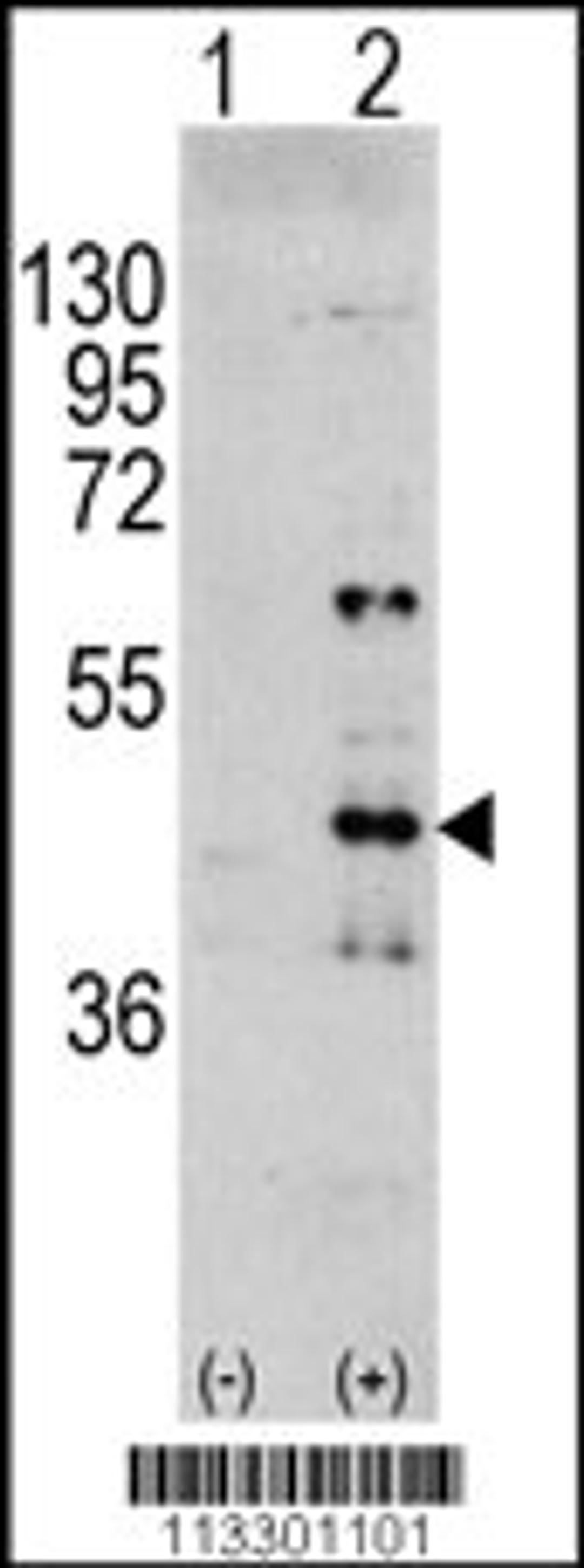 Western blot analysis of MAPK3 using rabbit polyclonal MAPK3 Antibody (Y204) using 293 cell lysates (2 ug/lane) either nontransfected (Lane 1) or transiently transfected with the MAPK3 gene (Lane 2).