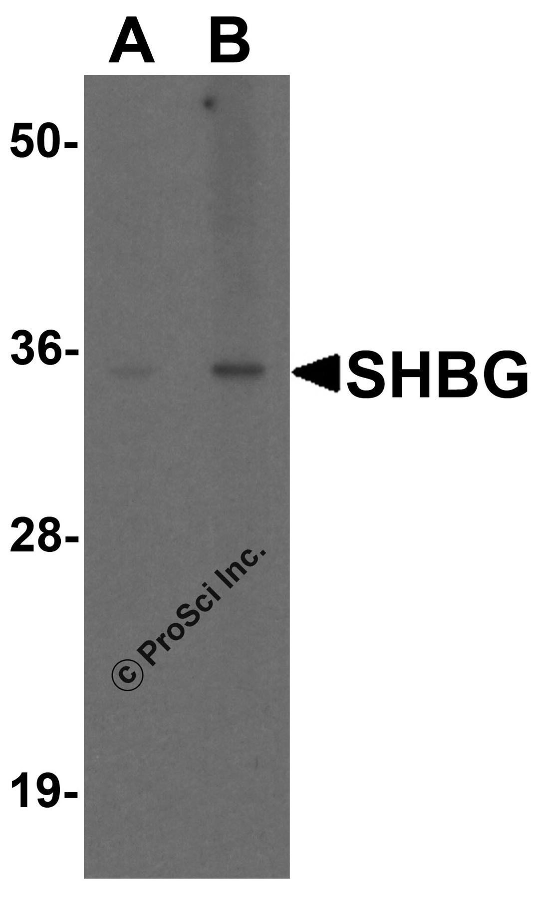 Western blot analysis of SHBG in human liver tissue lysate with SHBG antibody at (A) 1 and (B) 2 &#956;g/ml.