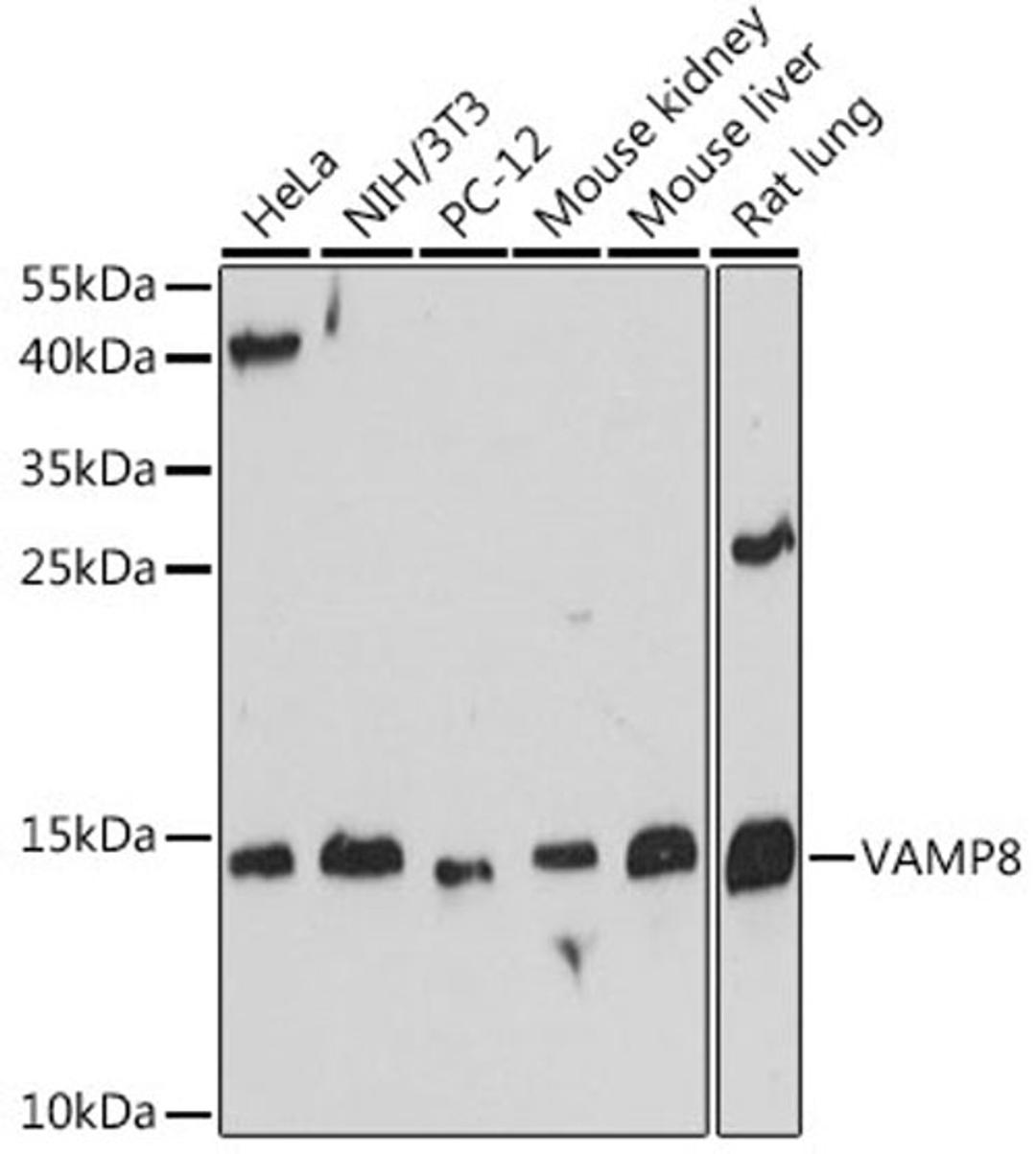 Western blot - VAMP8 antibody (A13915)