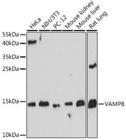 Western blot - VAMP8 antibody (A13915)