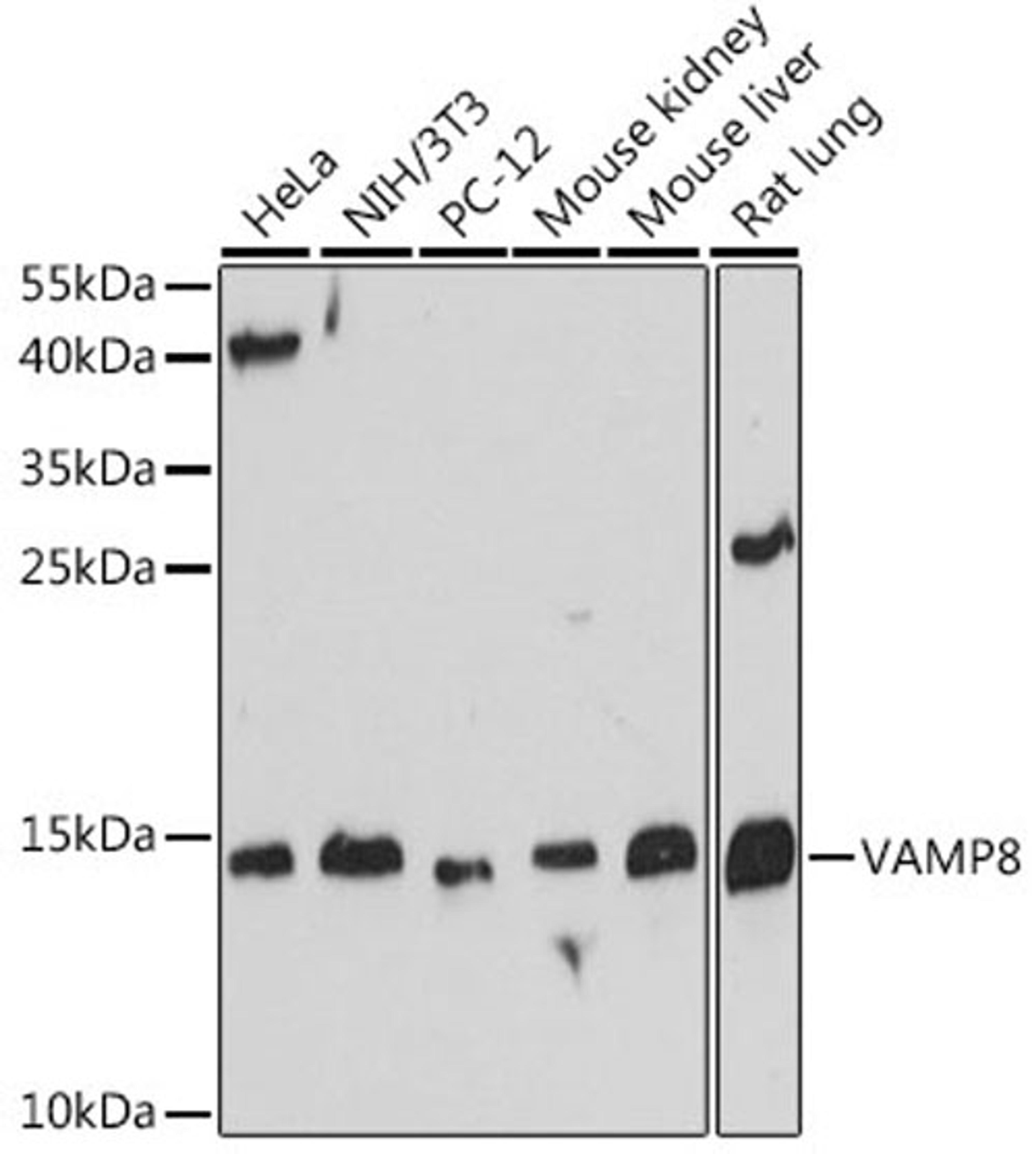 Western blot - VAMP8 antibody (A13915)