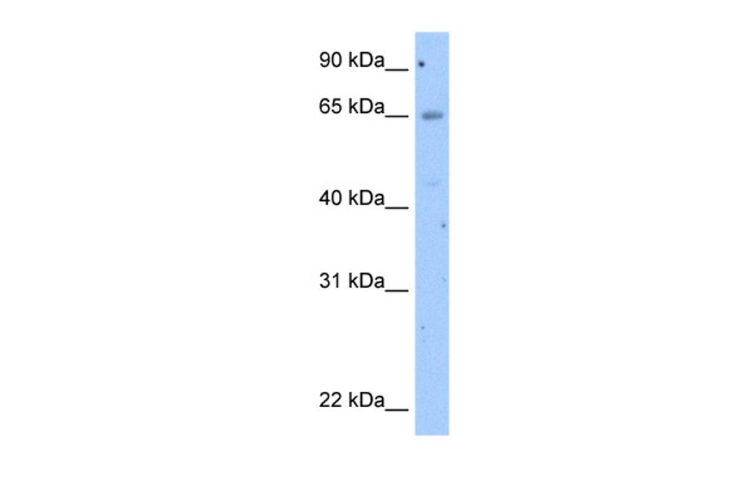 Antibody used in WB on Transfected 293T at 2.5 ug/ml.