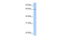 Antibody used in WB on Transfected 293T at 2.5 ug/ml.