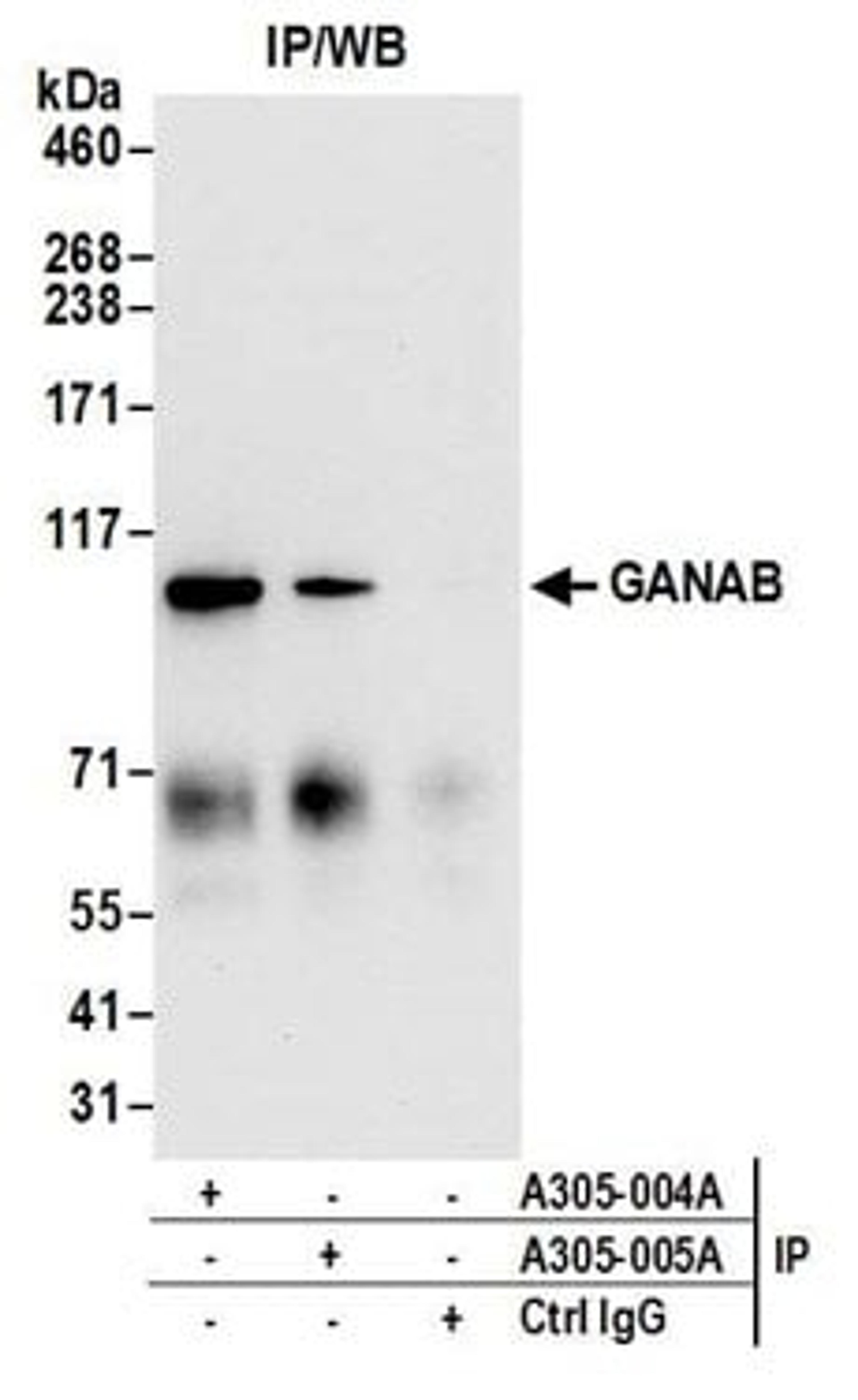 Detection of human GANAB by western blot of immunoprecipitates.