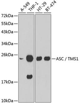 Western blot - ASC / TMS1 antibody (A1170)