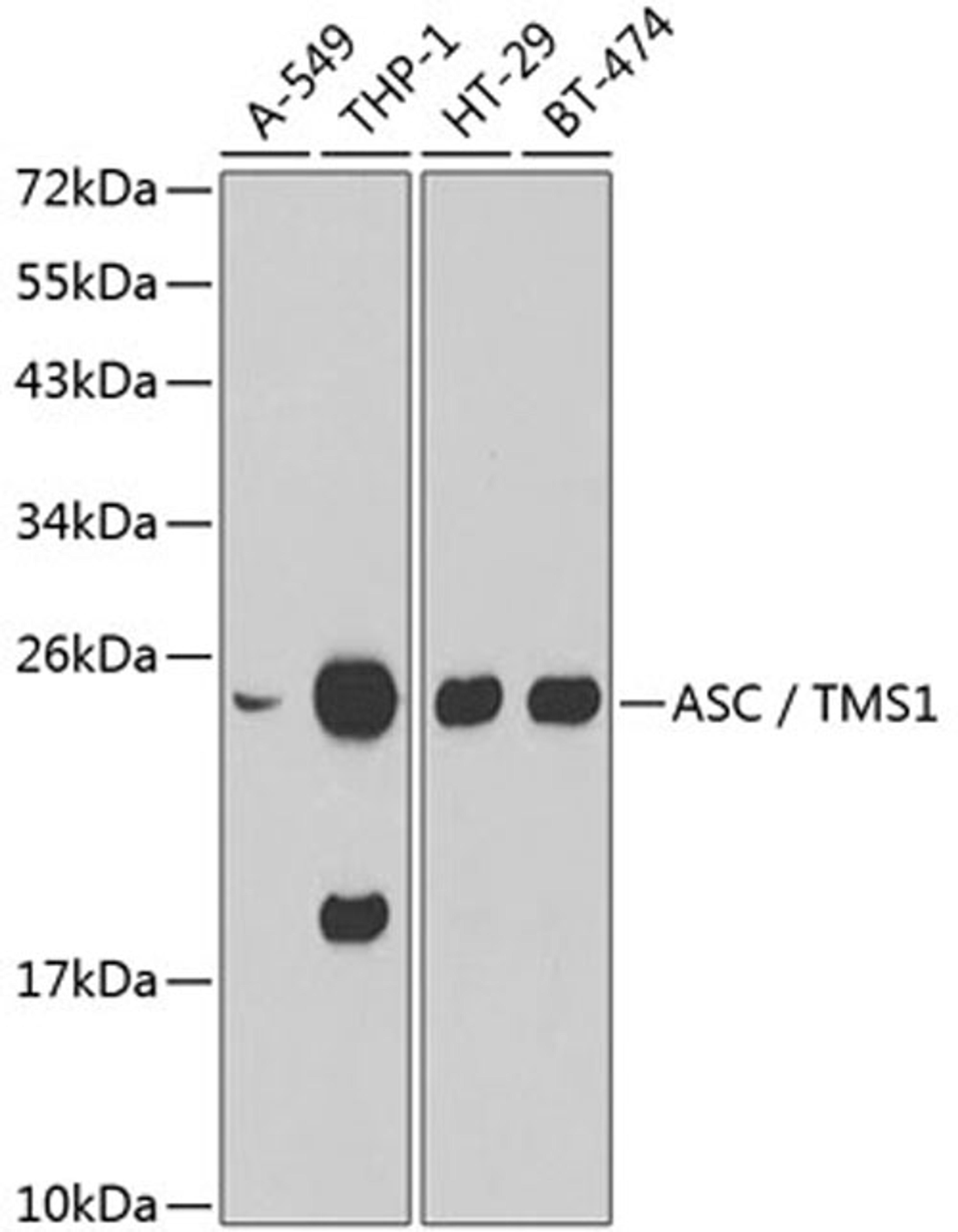 Western blot - ASC / TMS1 antibody (A1170)