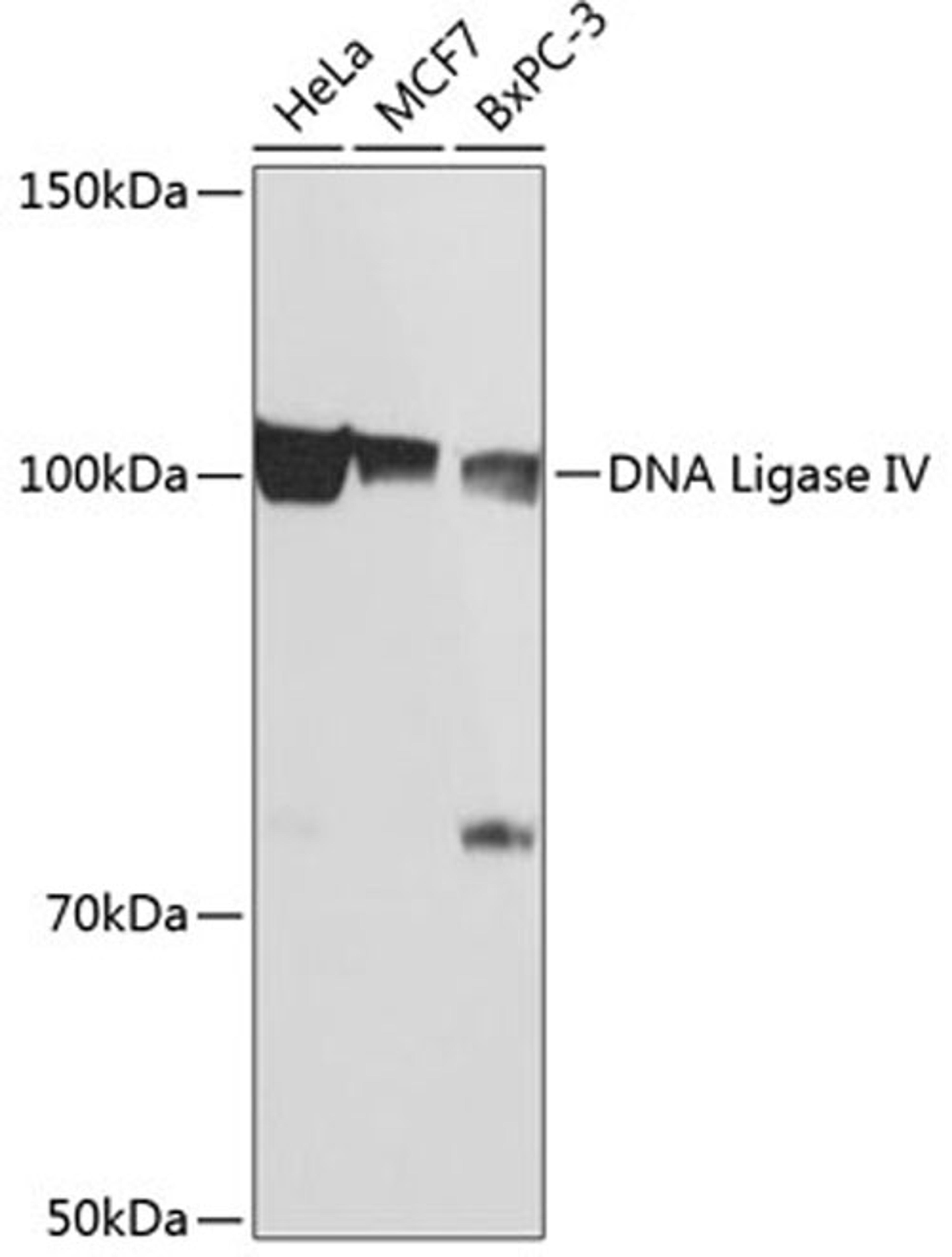 Western blot - DNA Ligase IV Rabbit mAb (A11432)