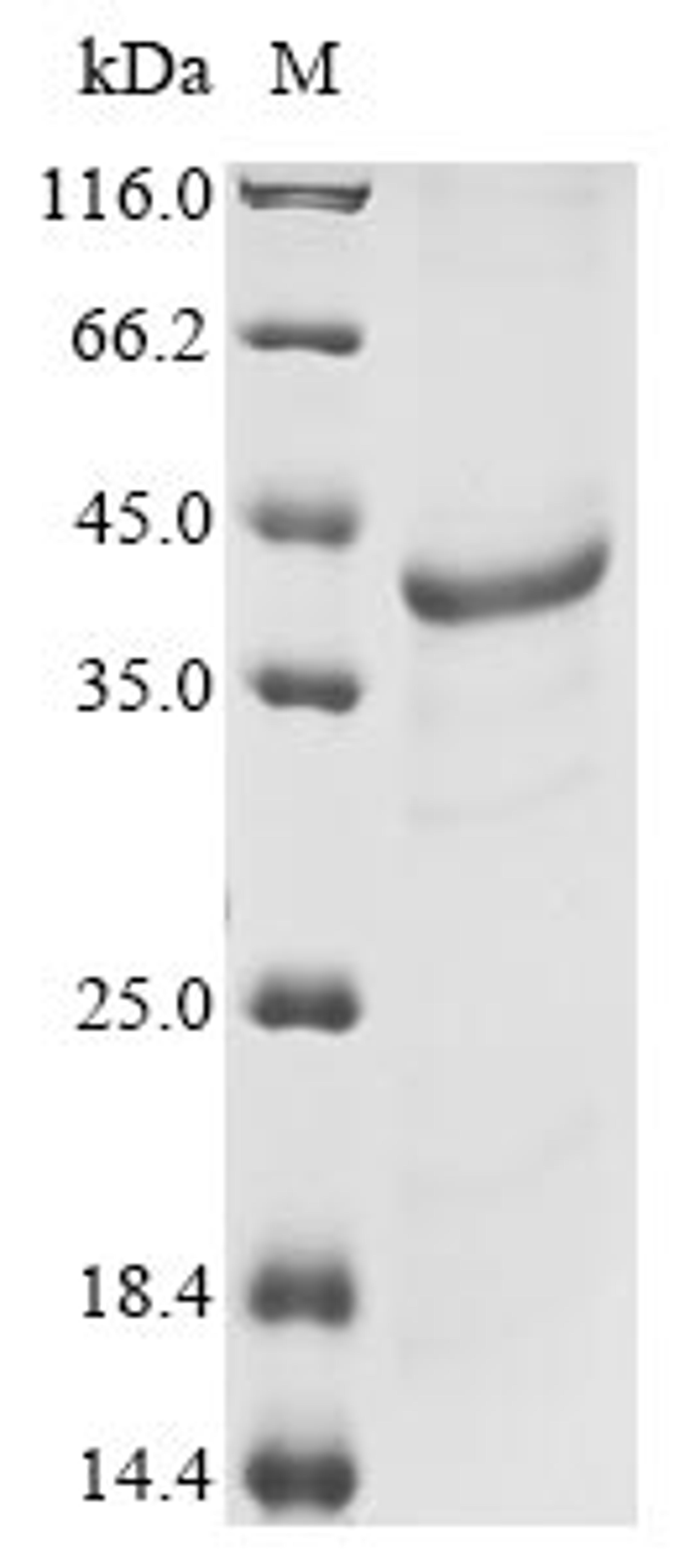 (Tris-Glycine gel) Discontinuous SDS-PAGE (reduced) with 5% enrichment gel and 15% separation gel.