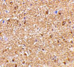 Immunohistochemical staining of mouse brain with Rabbit anti Human NogoA (AHP1799)