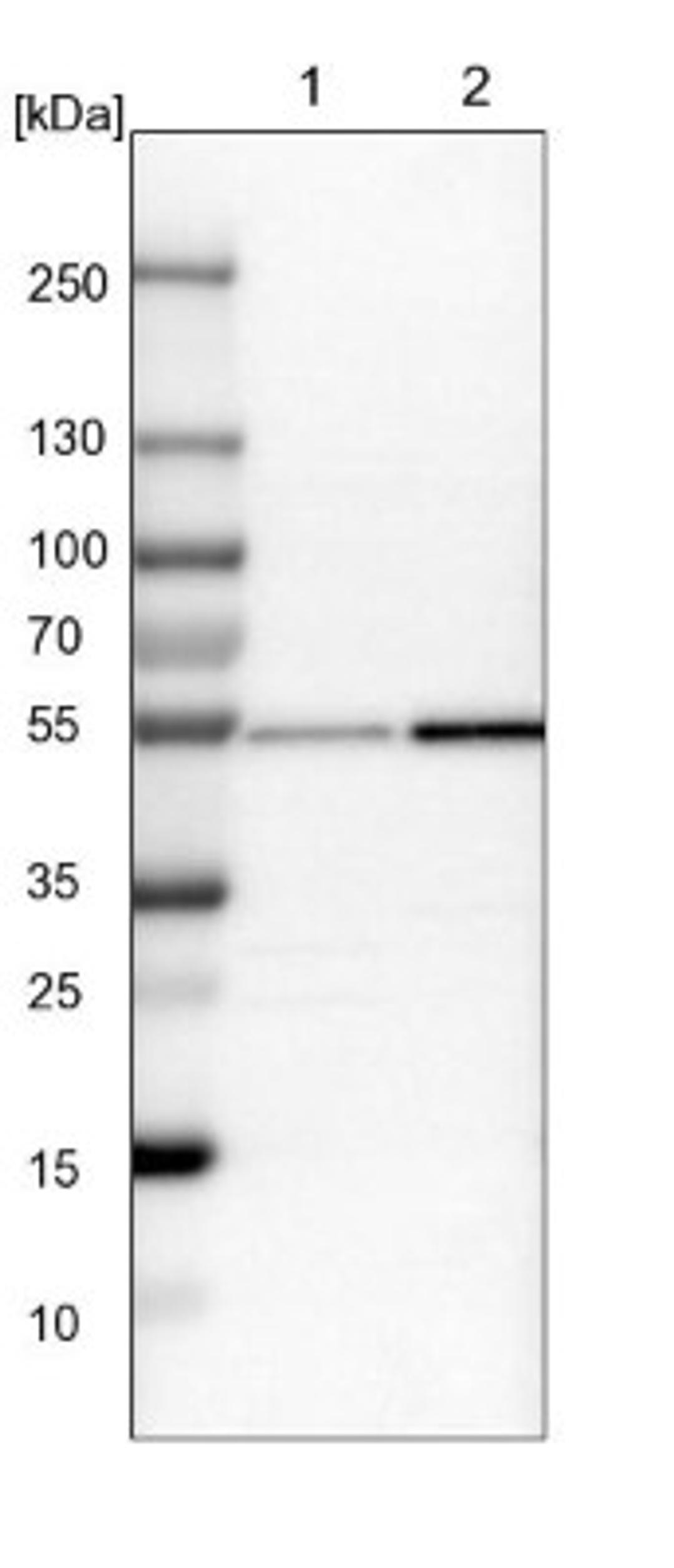 Western Blot: Nucleoredoxin Antibody [NBP1-82289] - Lane 1: NIH-3T3 cell lysate (Mouse embryonic fibroblast cells)<br/>Lane 2: NBT-II cell lysate (Rat Wistar bladder tumour cells)