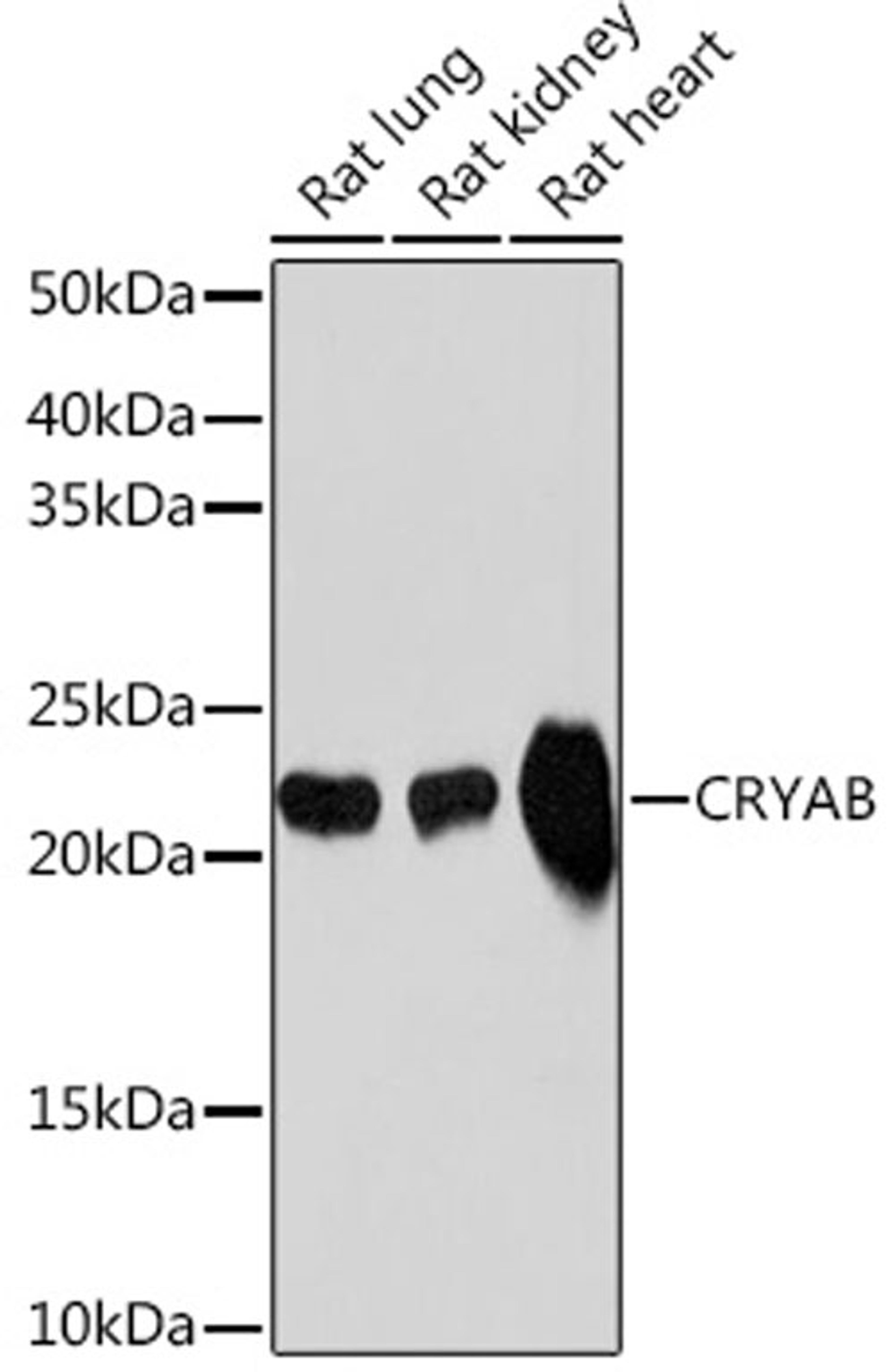 Western blot - CRYAB Rabbit mAb (A9633)