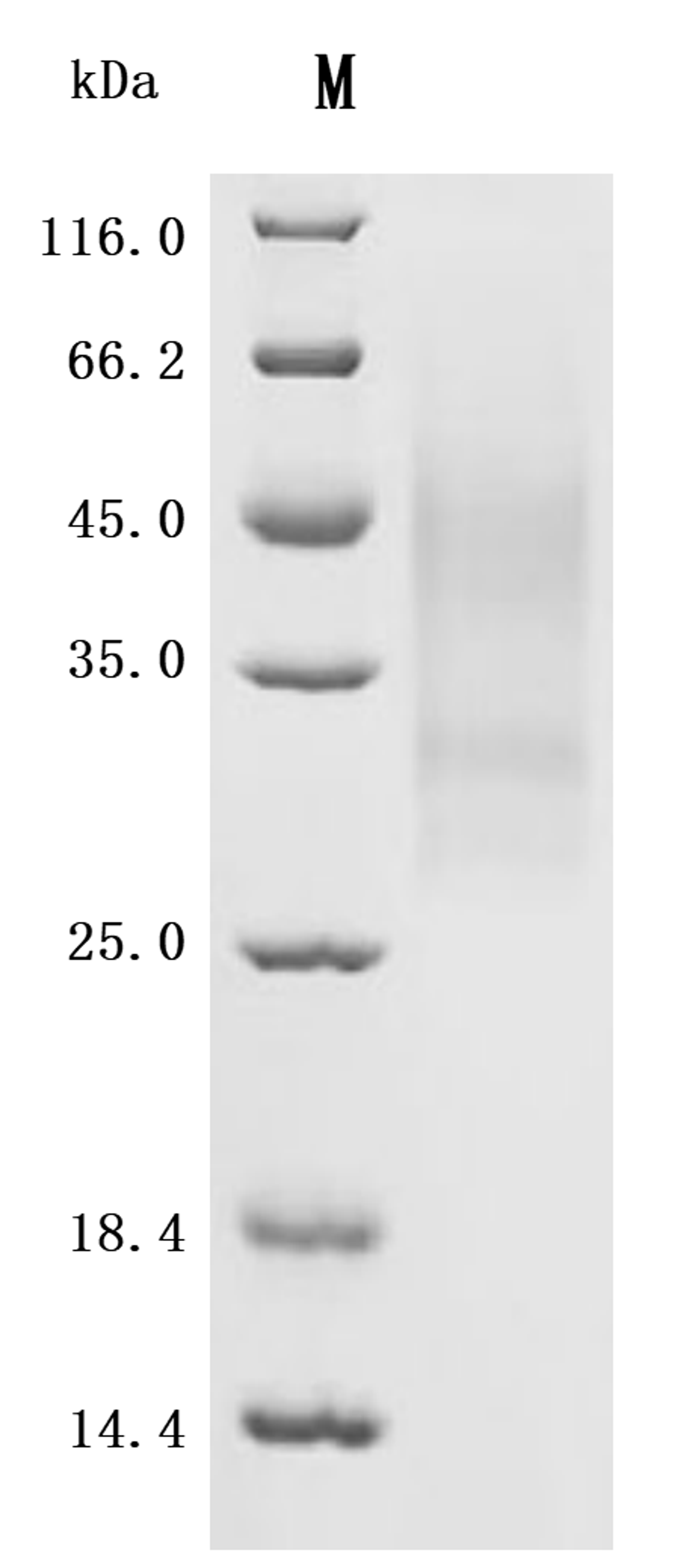 (Tris-Glycine gel) Discontinuous SDS-PAGE (reduced) with 5% enrichment gel and 15% separation gel.