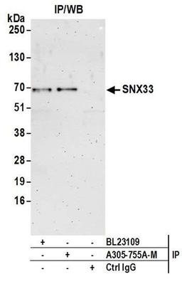 Detection of human SNX33 by WB of IP.