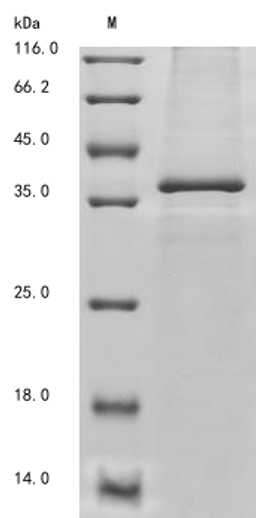 (Tris-Glycine gel) Discontinuous SDS-PAGE (reduced) with 5% enrichment gel and 15% separation gel.
