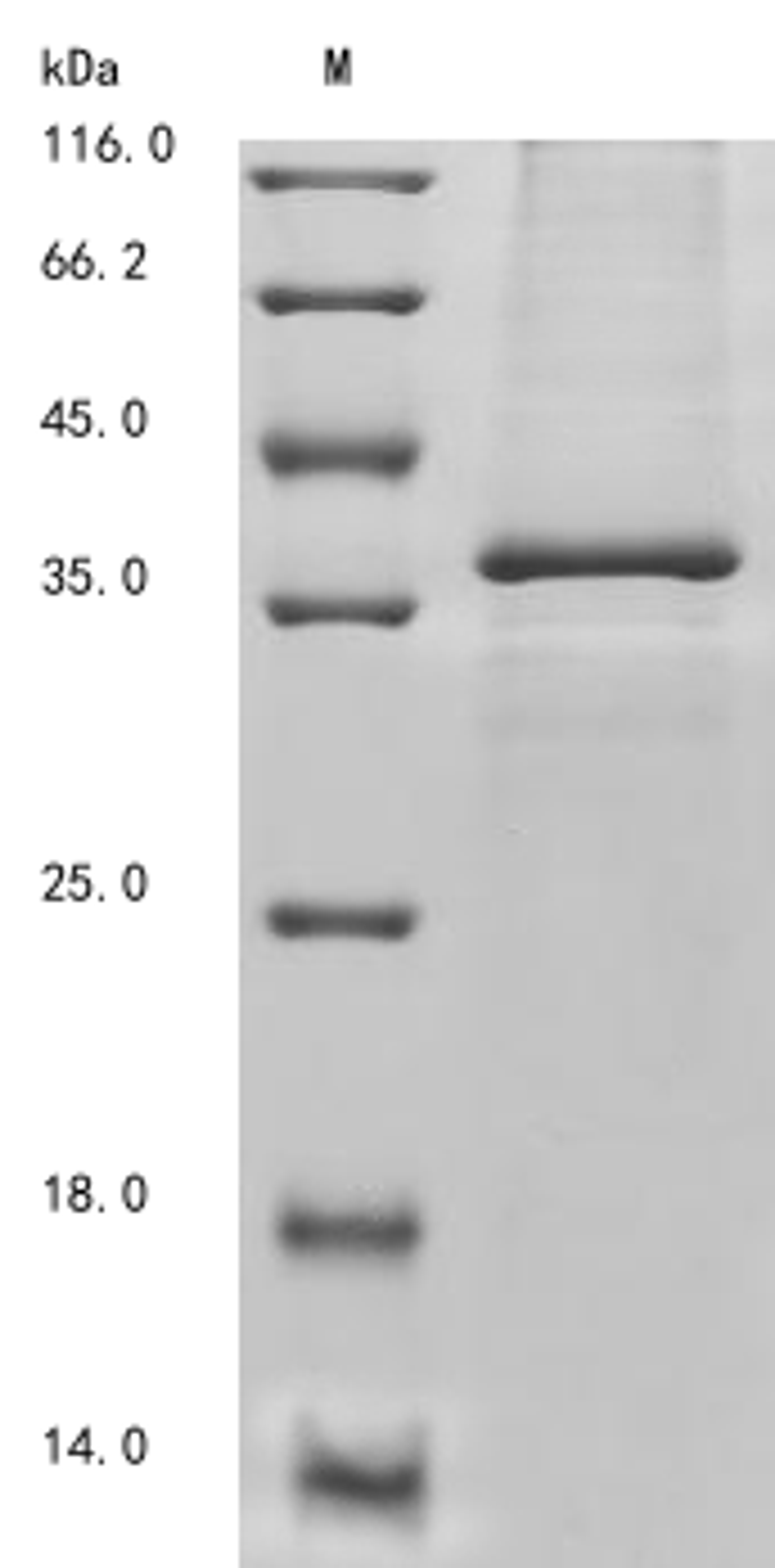 (Tris-Glycine gel) Discontinuous SDS-PAGE (reduced) with 5% enrichment gel and 15% separation gel.