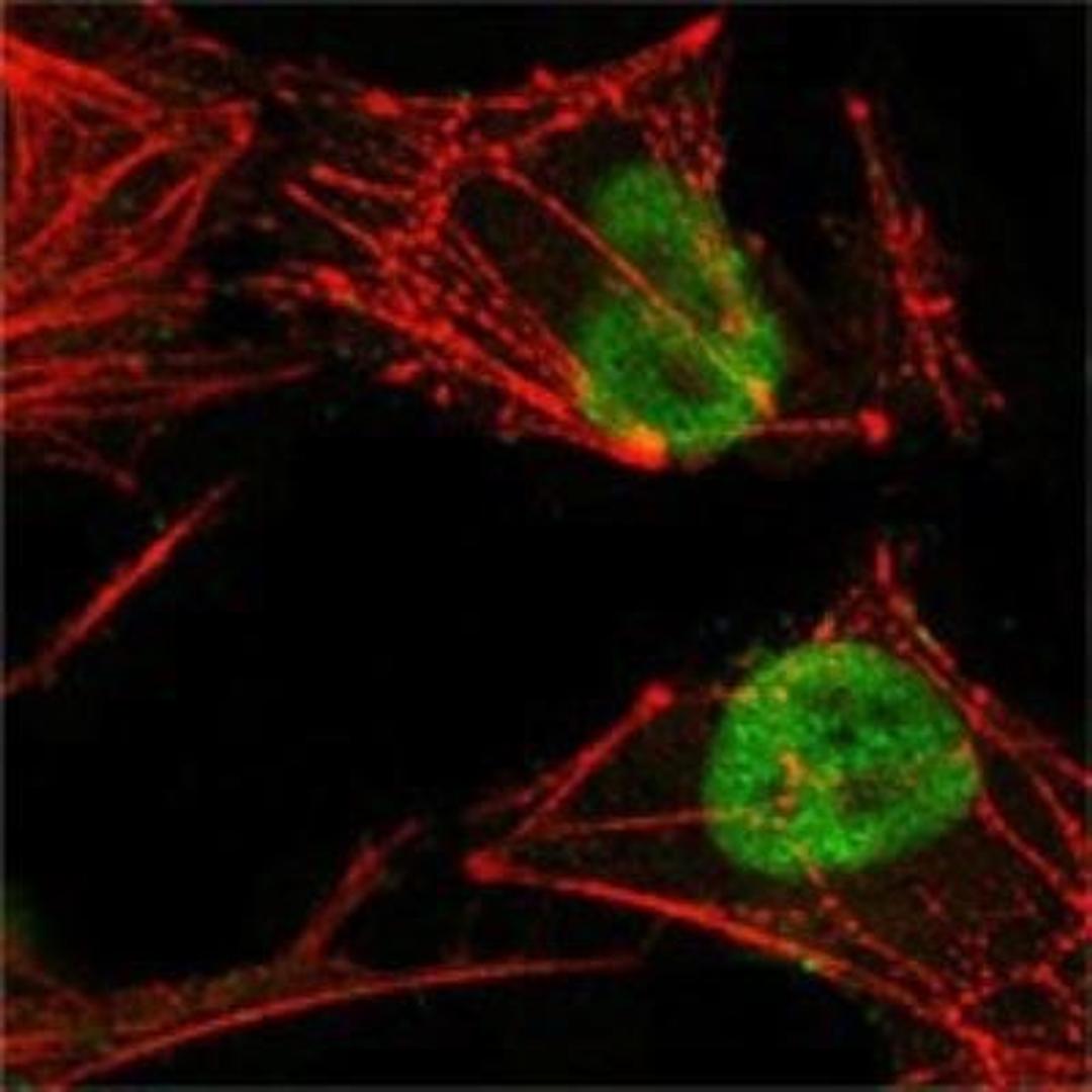 Immunocytochemistry/Immunofluorescence: MSH2 Antibody (1B3) [NB100-1767] - Analysis of Hela cells using MSH2 mouse mAb (green), showing nuclear localization. Red: Actin filaments have been labeled with Alexa Fluor-555 phalloidin.