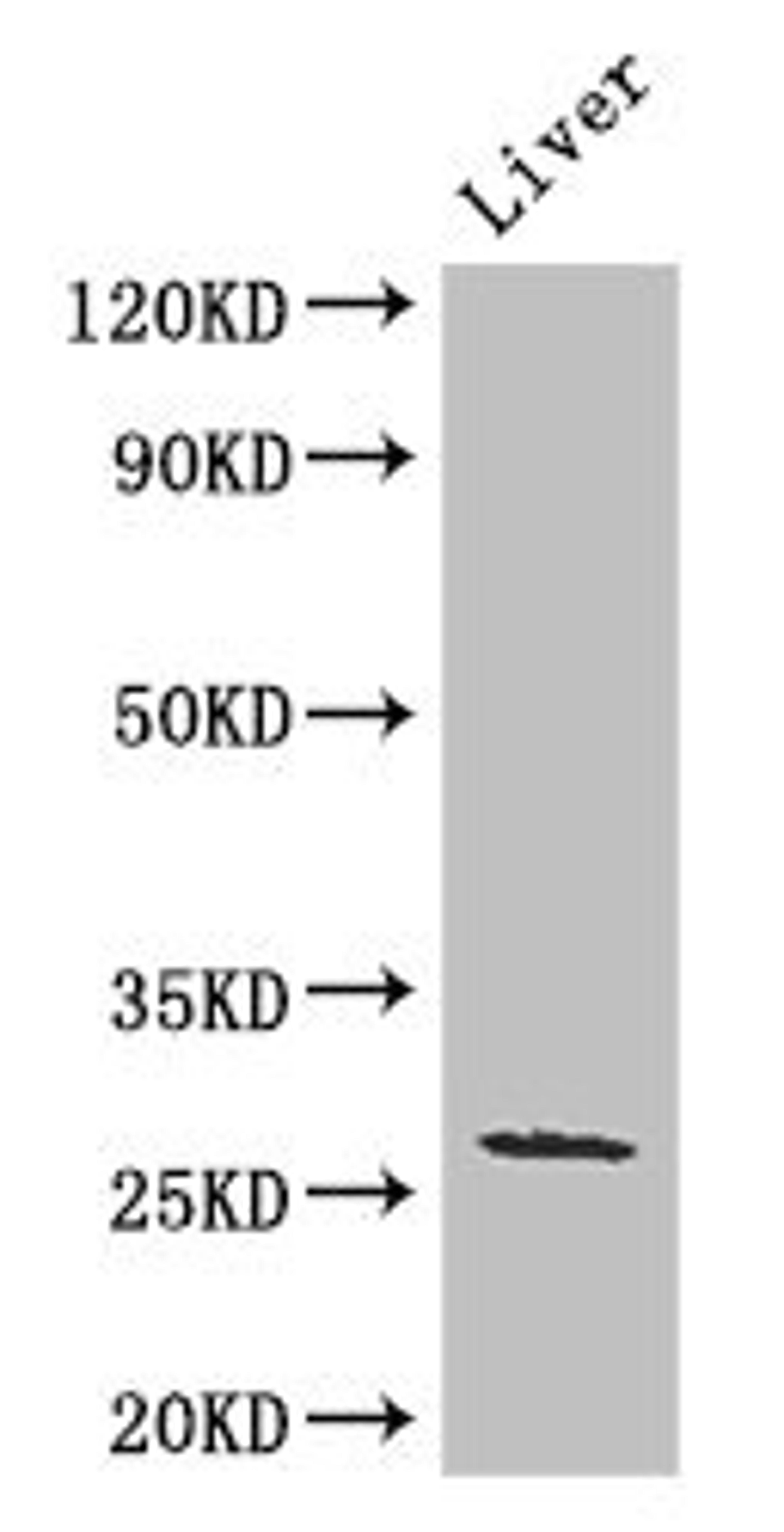 Western Blot. Positive WB detected in: Mouse liver tissue. All lanes: GJB2 antibody at 3ug/ml. Secondary. Goat polyclonal to rabbit IgG at 1/50000 dilution. Predicted band size: 27 kDa. Observed band size: 27 kDa.