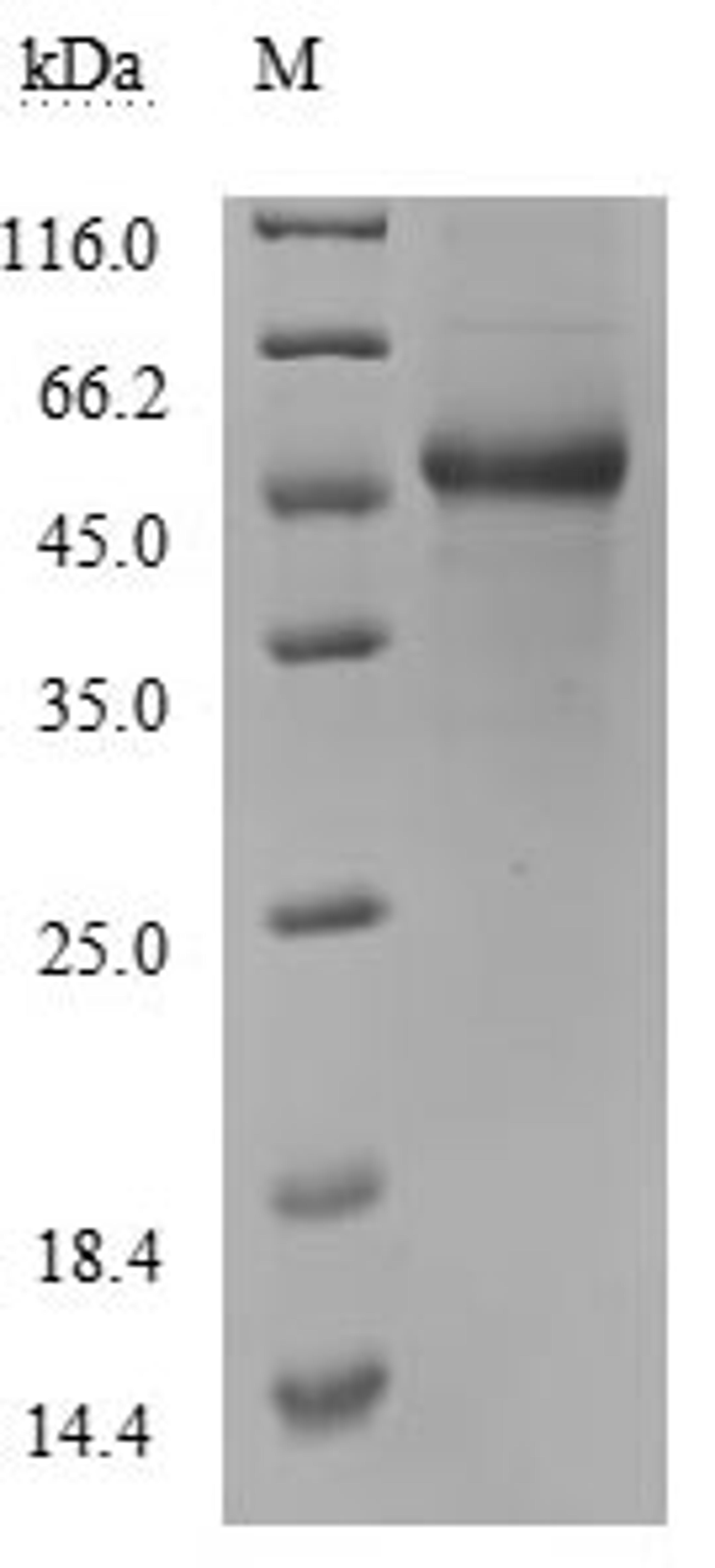 (Tris-Glycine gel) Discontinuous SDS-PAGE (reduced) with 5% enrichment gel and 15% separation gel.
