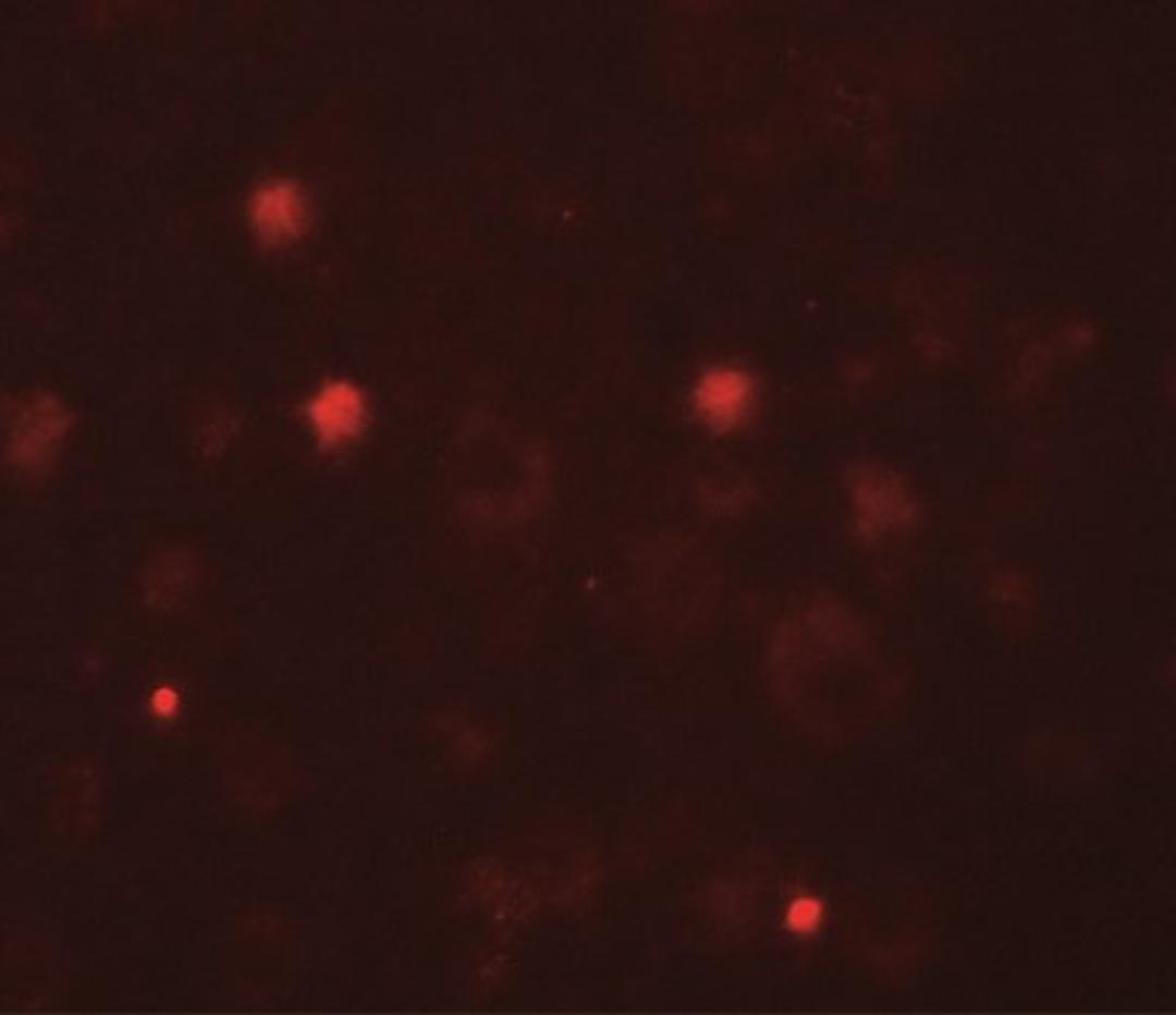 Immunocytochemistry/Immunofluorescence: KCNK13 Antibody [NBP2-41132] - Immunofluorescence of KCNK13 in human brain tissue with KCNK13 antibody at 20 ug/mL.