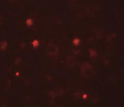 Immunocytochemistry/Immunofluorescence: KCNK13 Antibody [NBP2-41132] - Immunofluorescence of KCNK13 in human brain tissue with KCNK13 antibody at 20 ug/mL.