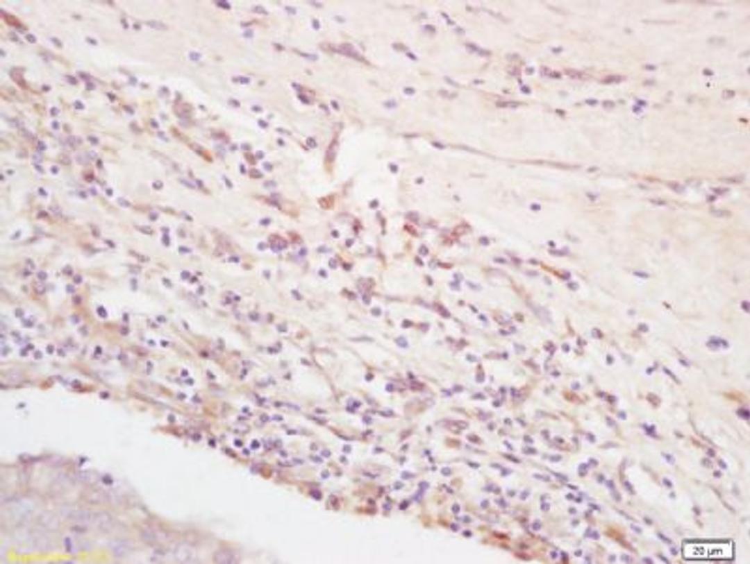 Immunohistochemical staining of rat brain tissue using Integrin alpha 5 beta 3 antibody.