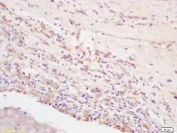 Immunohistochemical staining of rat brain tissue using Integrin alpha 5 beta 3 antibody.