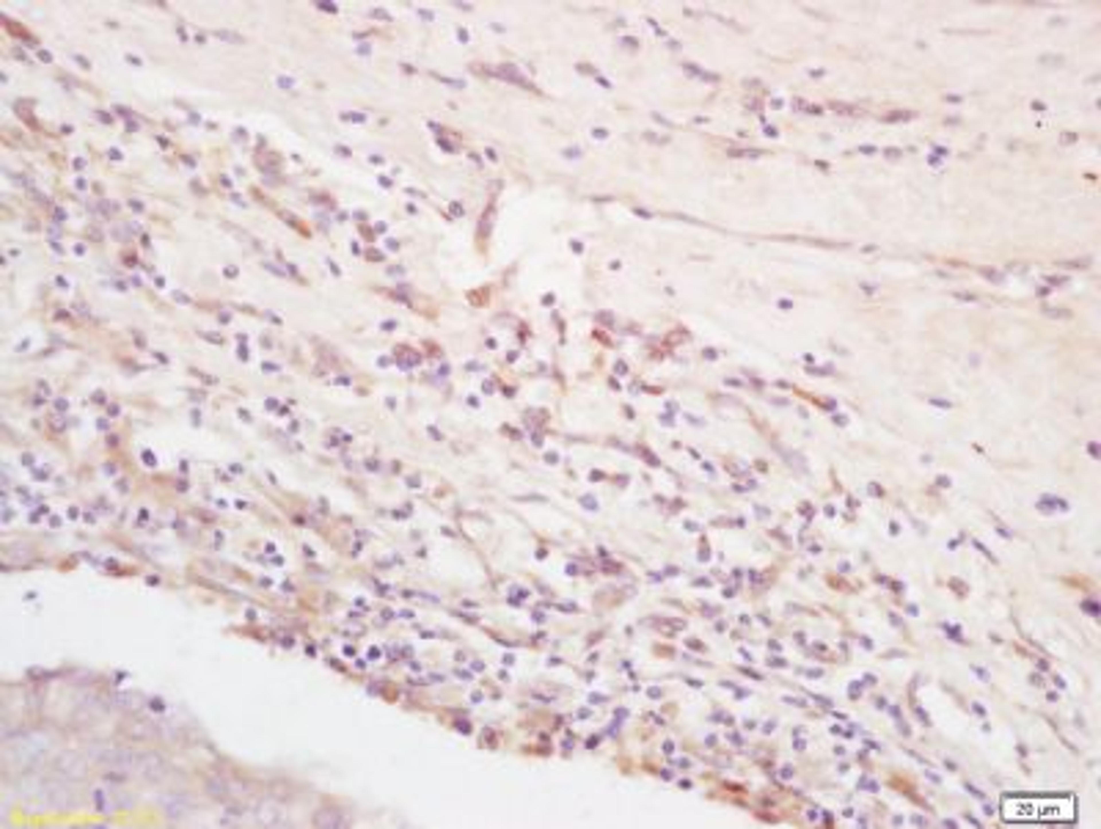 Immunohistochemical staining of rat brain tissue using Integrin alpha 5 beta 3 antibody.