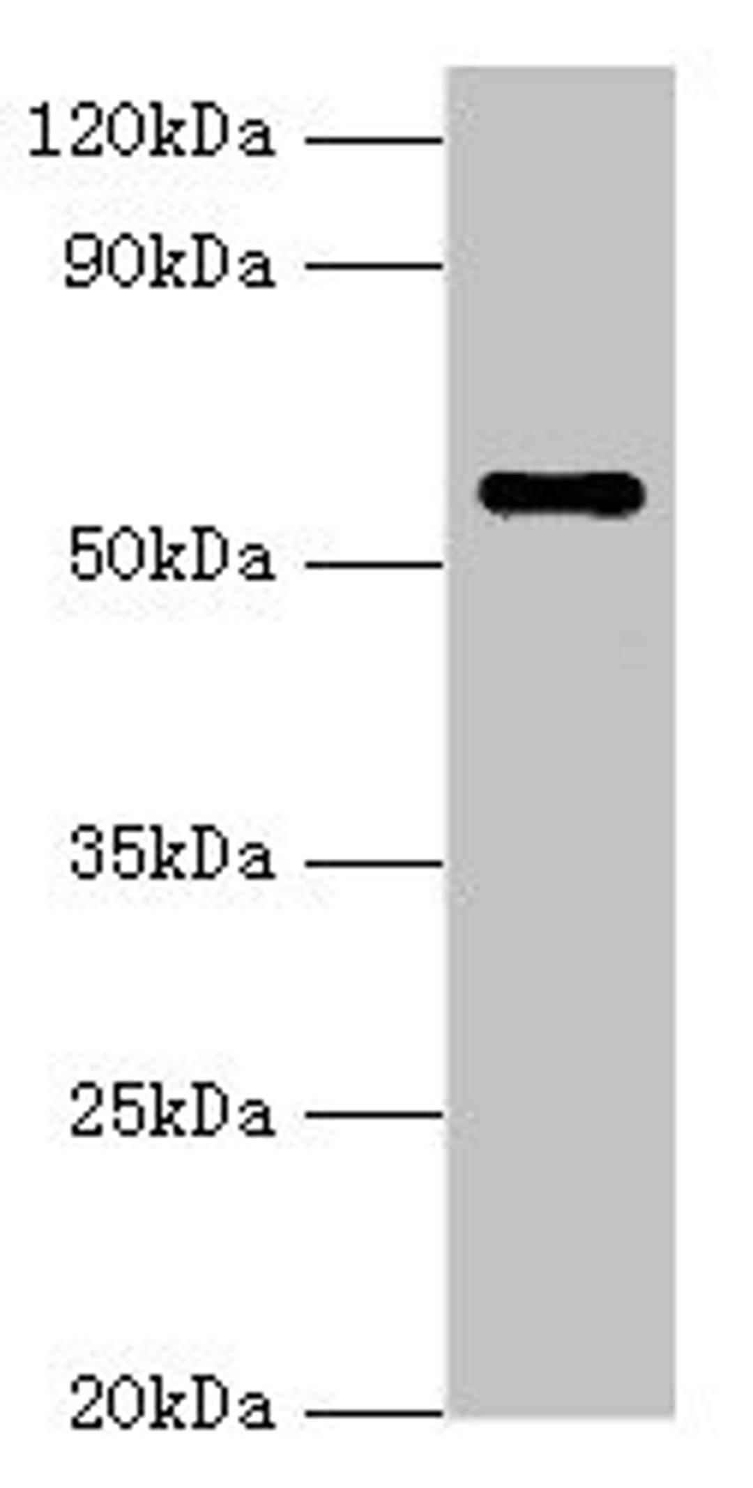 Western blot. All lanes: NAB2 antibody at 3µg/ml + Hela whole cell lysate. Secondary. Goat polyclonal to rabbit IgG at 1/10000 dilution. Predicted band size: 57, 35, 50 kDa. Observed band size: 57 kDa