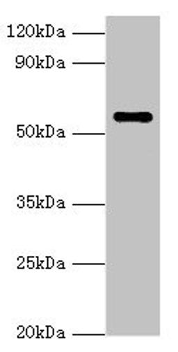 Western blot. All lanes: NAB2 antibody at 3µg/ml + Hela whole cell lysate. Secondary. Goat polyclonal to rabbit IgG at 1/10000 dilution. Predicted band size: 57, 35, 50 kDa. Observed band size: 57 kDa