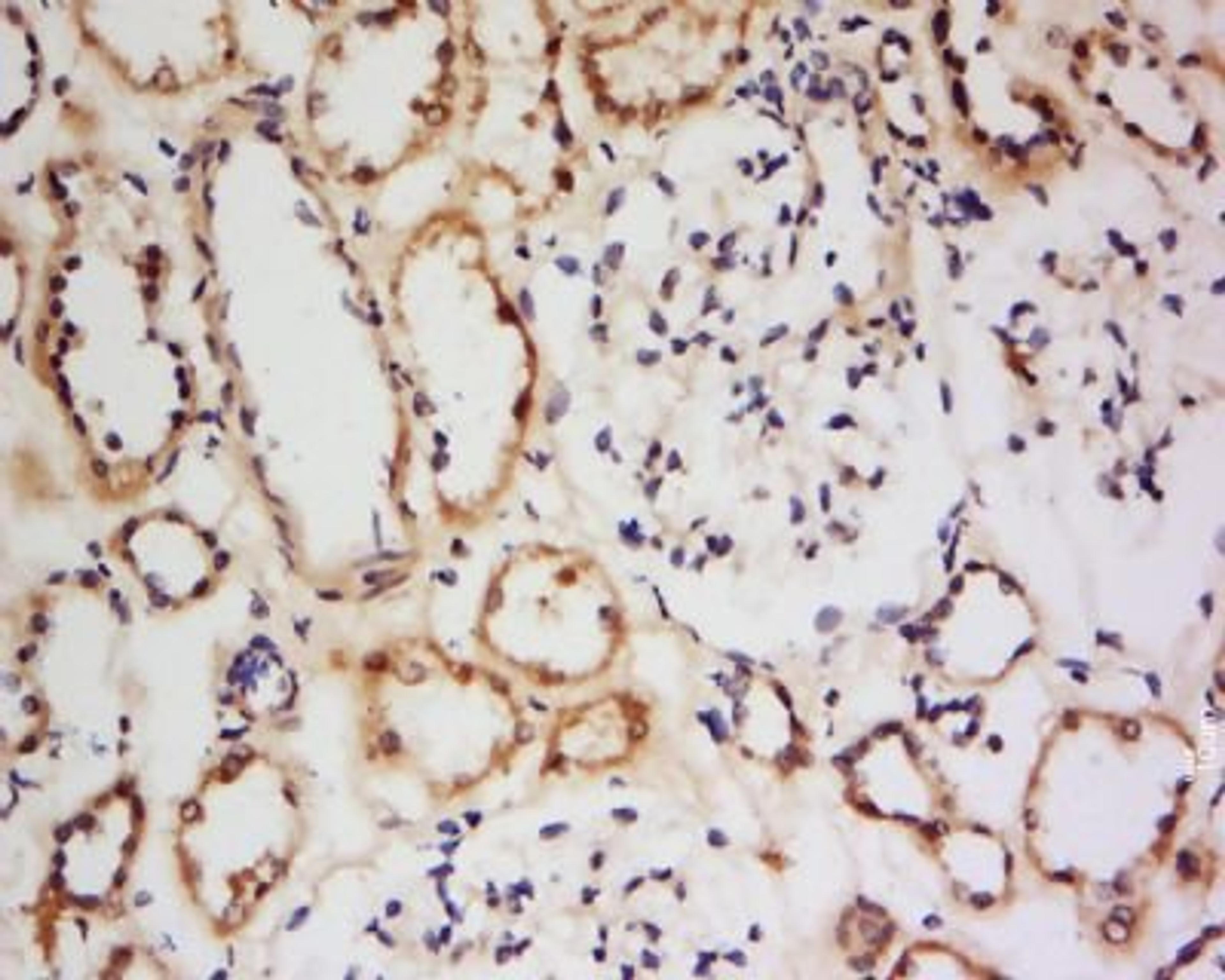 Immunohistochemical staining of human kidney tissue using CNGB3 antibody.