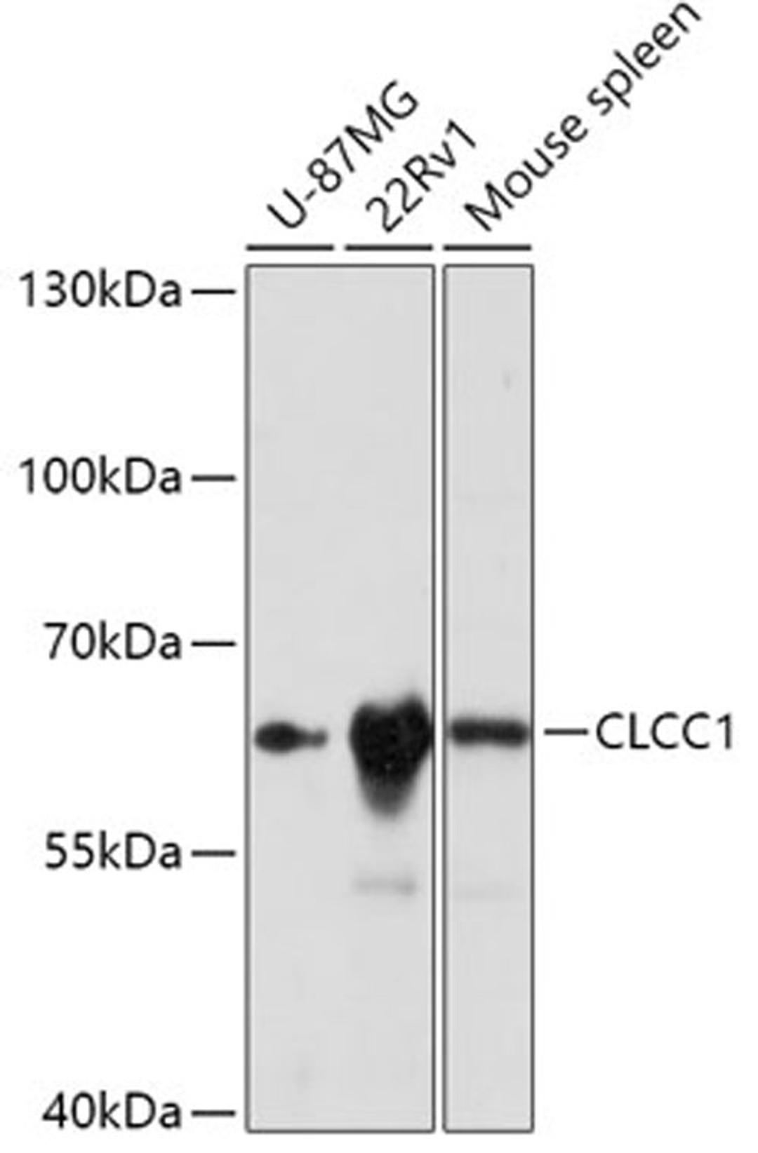 Western blot - CLCC1 antibody (A17656)
