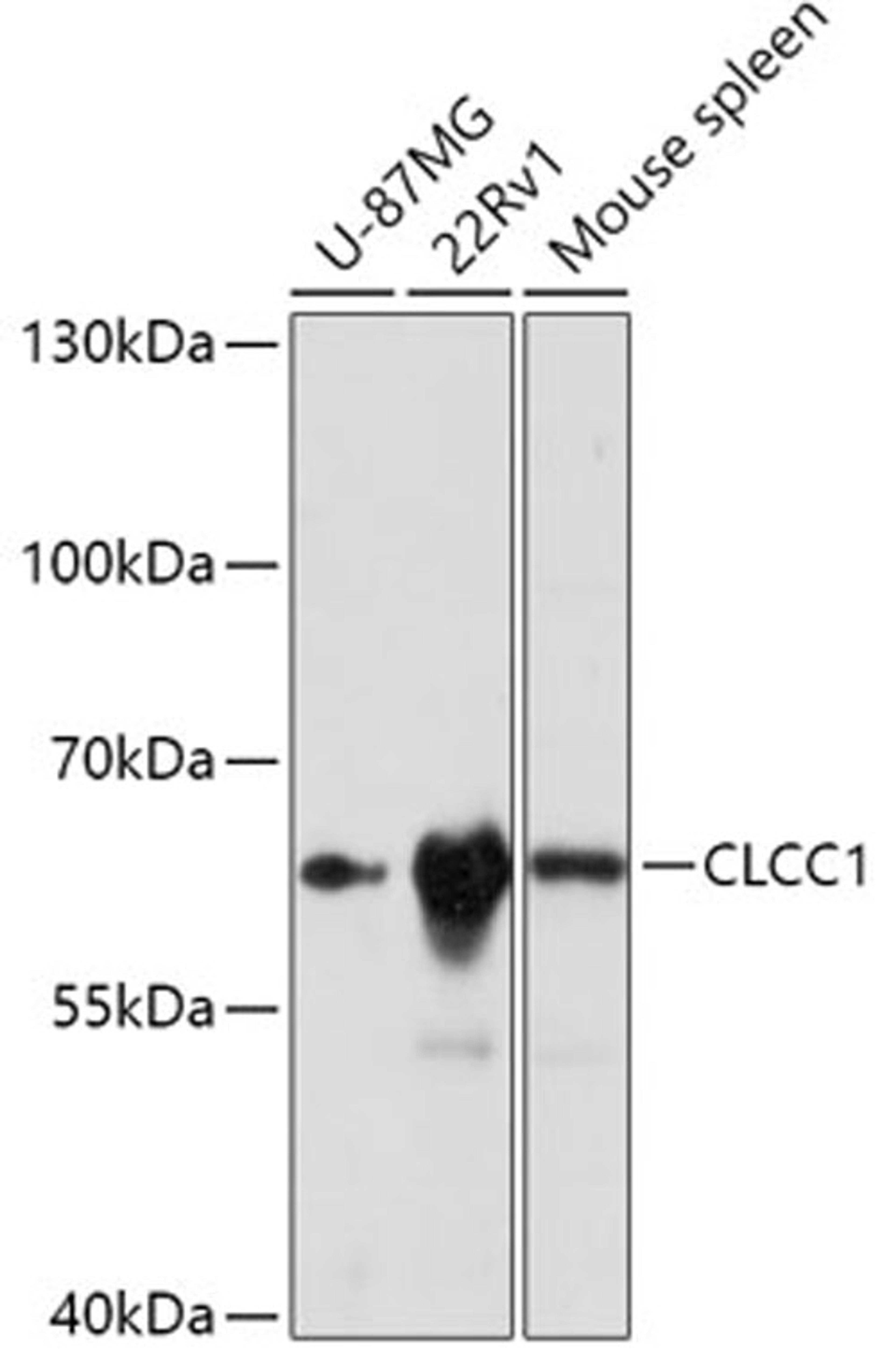 Western blot - CLCC1 antibody (A17656)