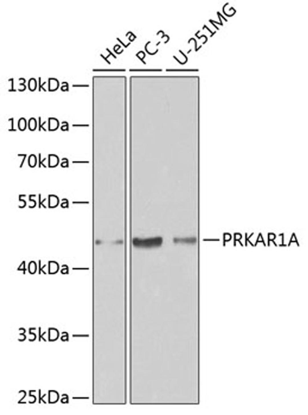 Western blot - PRKAR1A antibody (A0906)