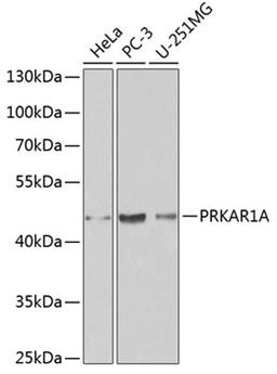 Western blot - PRKAR1A antibody (A0906)