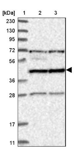 Western Blot: RSPH9 Antibody [NBP1-86750] - Lane 1: Marker [kDa] 230, 130, 95, 72, 56, 36, 28, 17, 11<br/>Lane 2: Human cell line RT-4<br/>Lane 3: Human cell line U-251MG sp