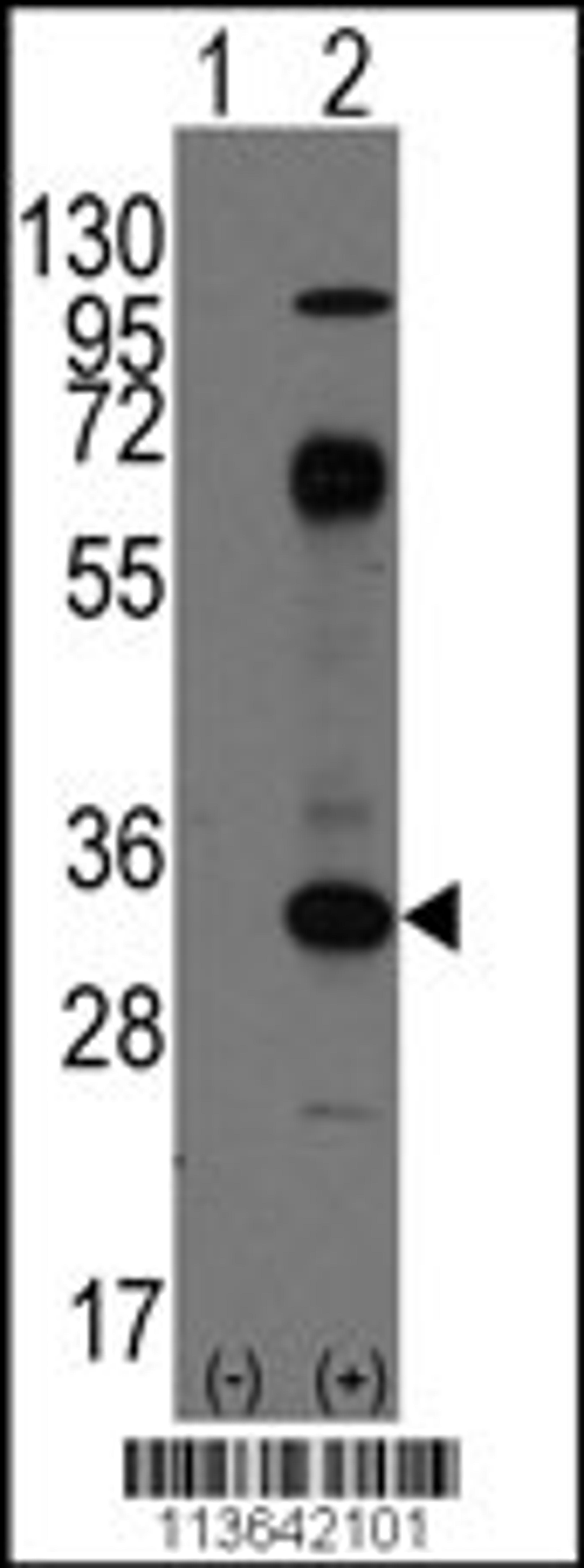 Western blot analysis of CD8A using rabbit polyclonal CD8A Antibody using 293 cell lysates (2 ug/lane) either nontransfected (Lane 1) or transiently transfected with the CD8A gene (Lane 2).