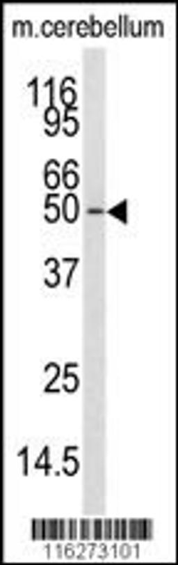 Western blot analysis of anti-CAMKK1 Antibody in mouse cerebellum tissue lysates (35ug/lane)